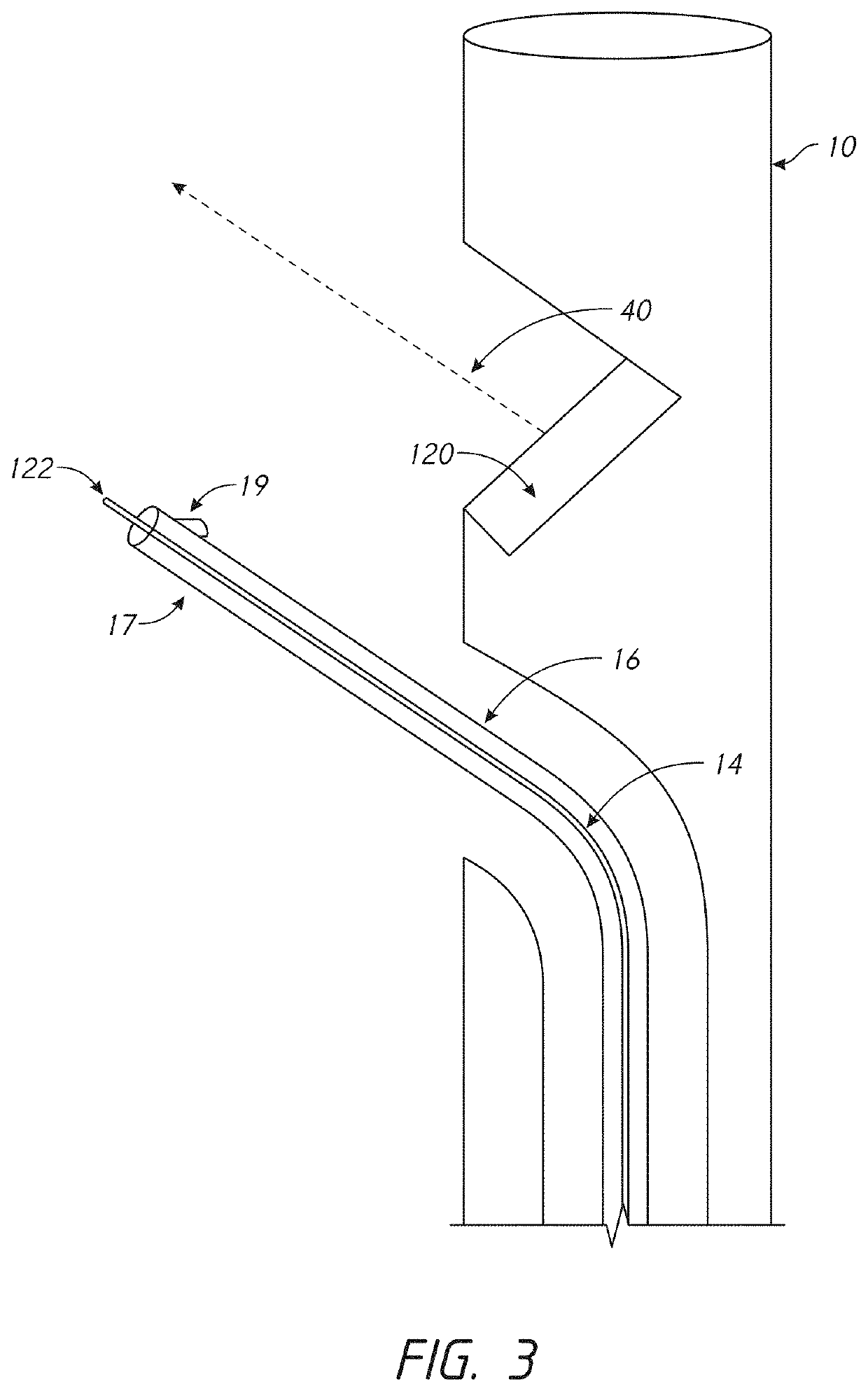 Devices and methods for increasing blood perfusion to a distal extremity