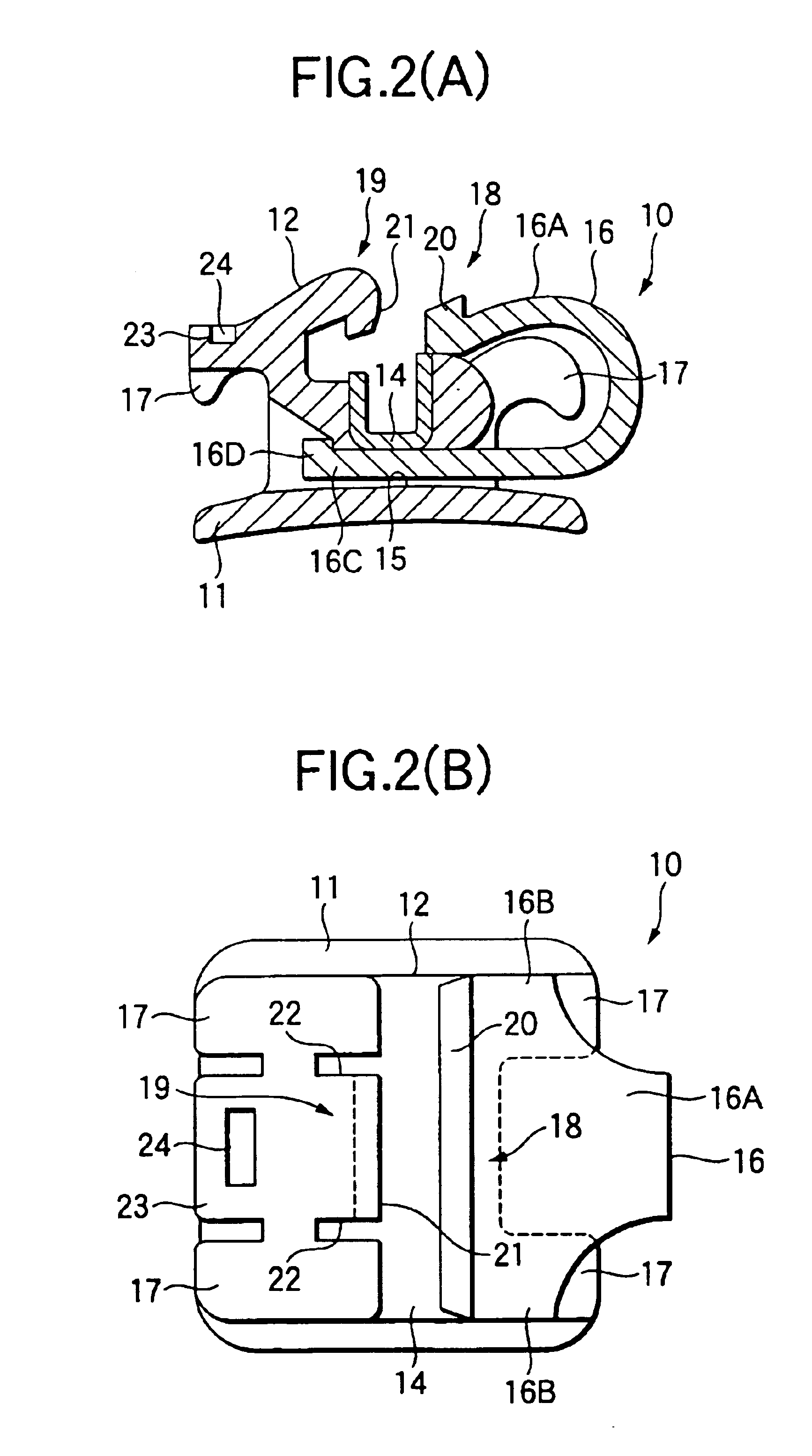 Orthodontic bracket