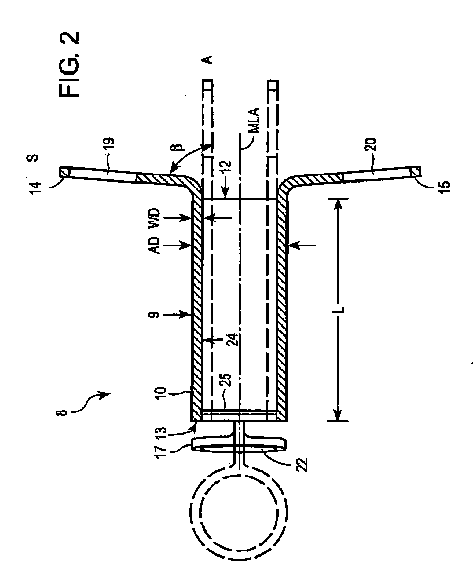 Tracheostoma spacer, tracheotomy method, and device for inserting a tracheostoma spacer