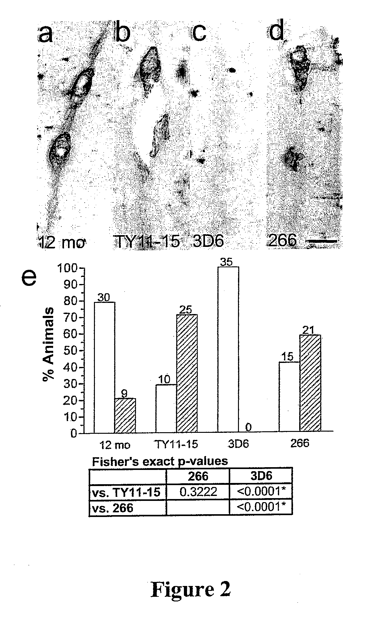 Prevention and treatment of cerebral amyloid angiopathy