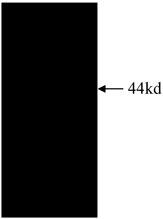 Heat-resistant cysteine protease, and coding genes and applications thereof