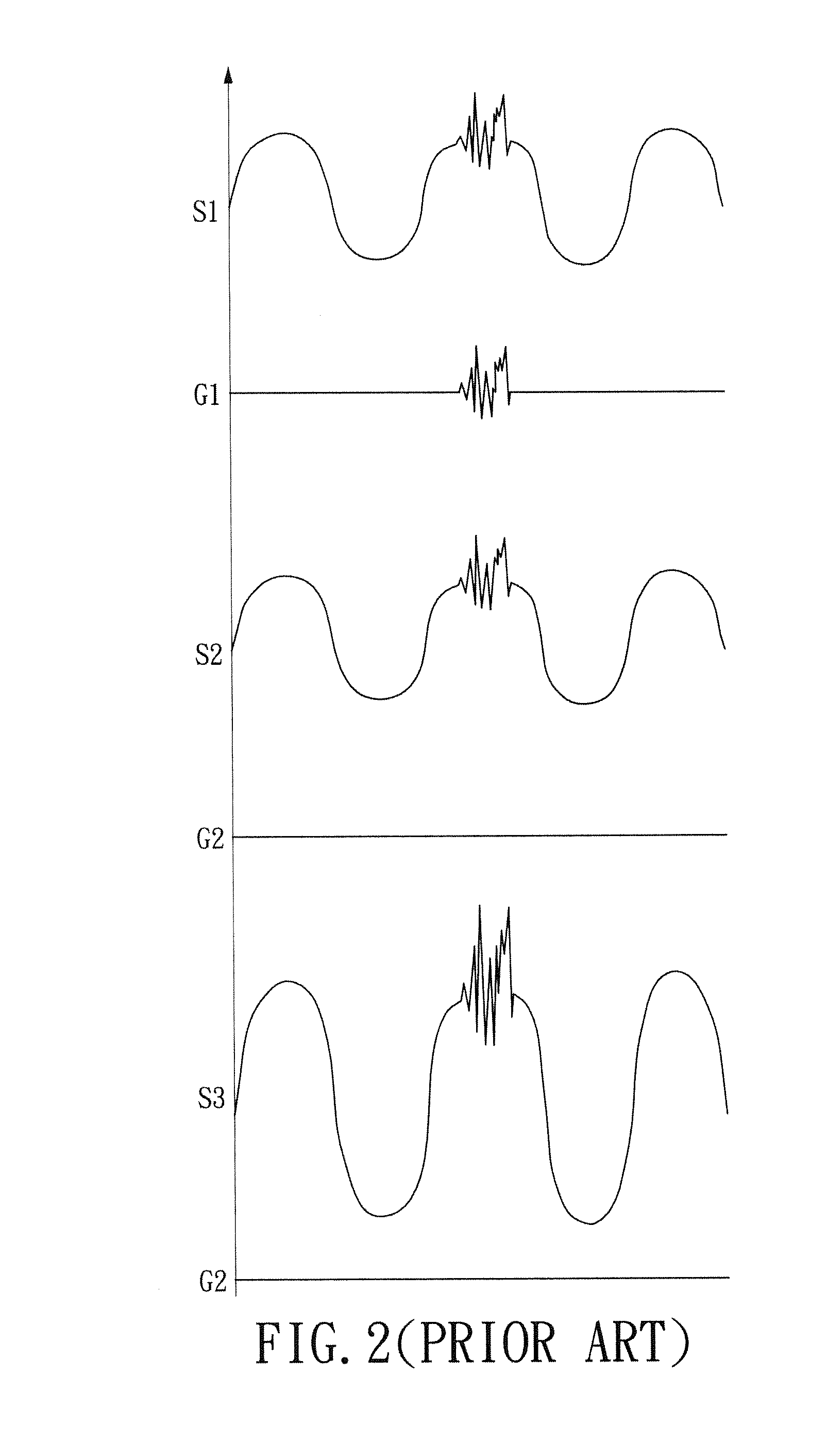 Common mode noise cancellation circuit for unbalanced signals