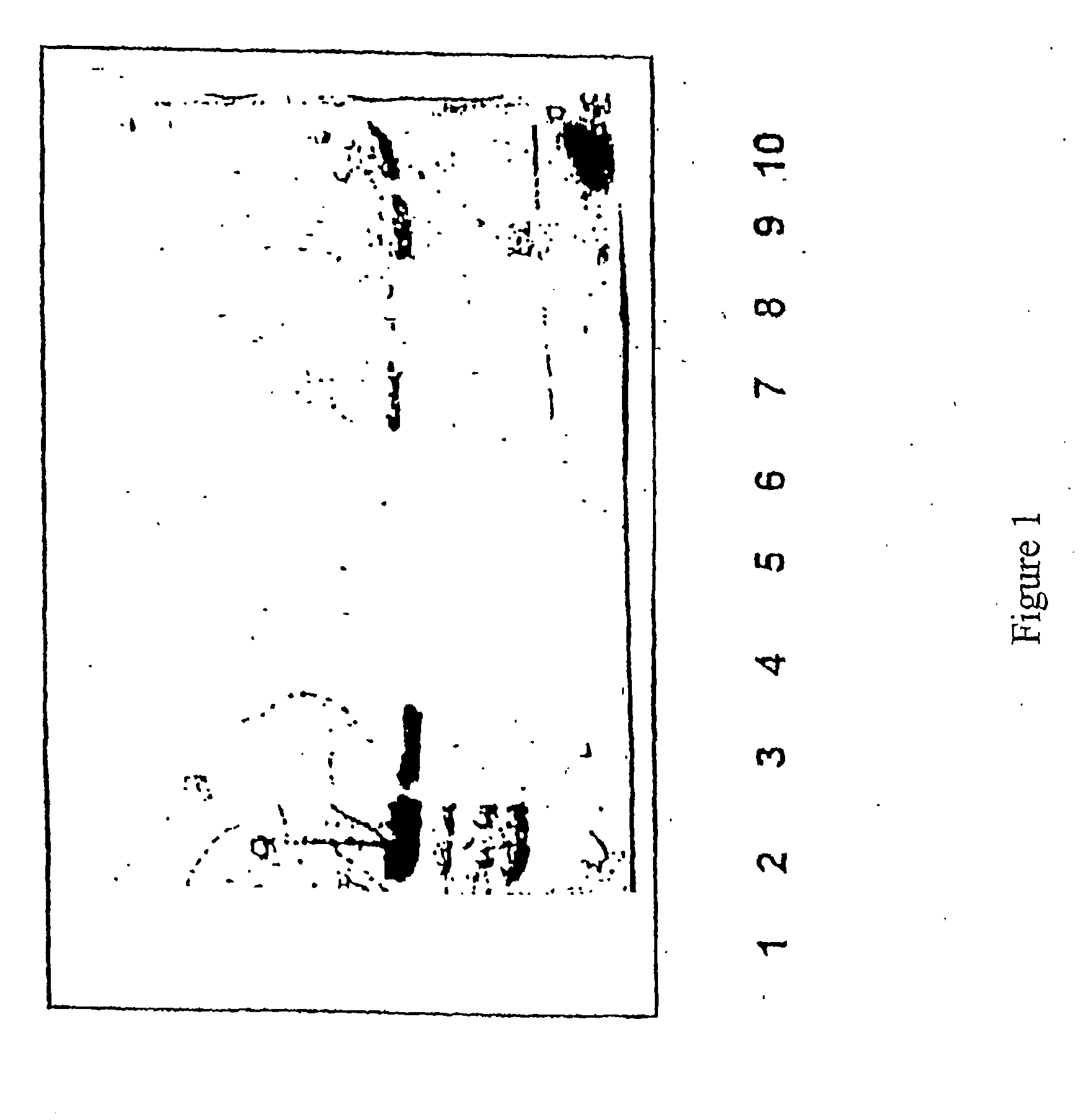 Methods for the Detection of Colorectal Cancer