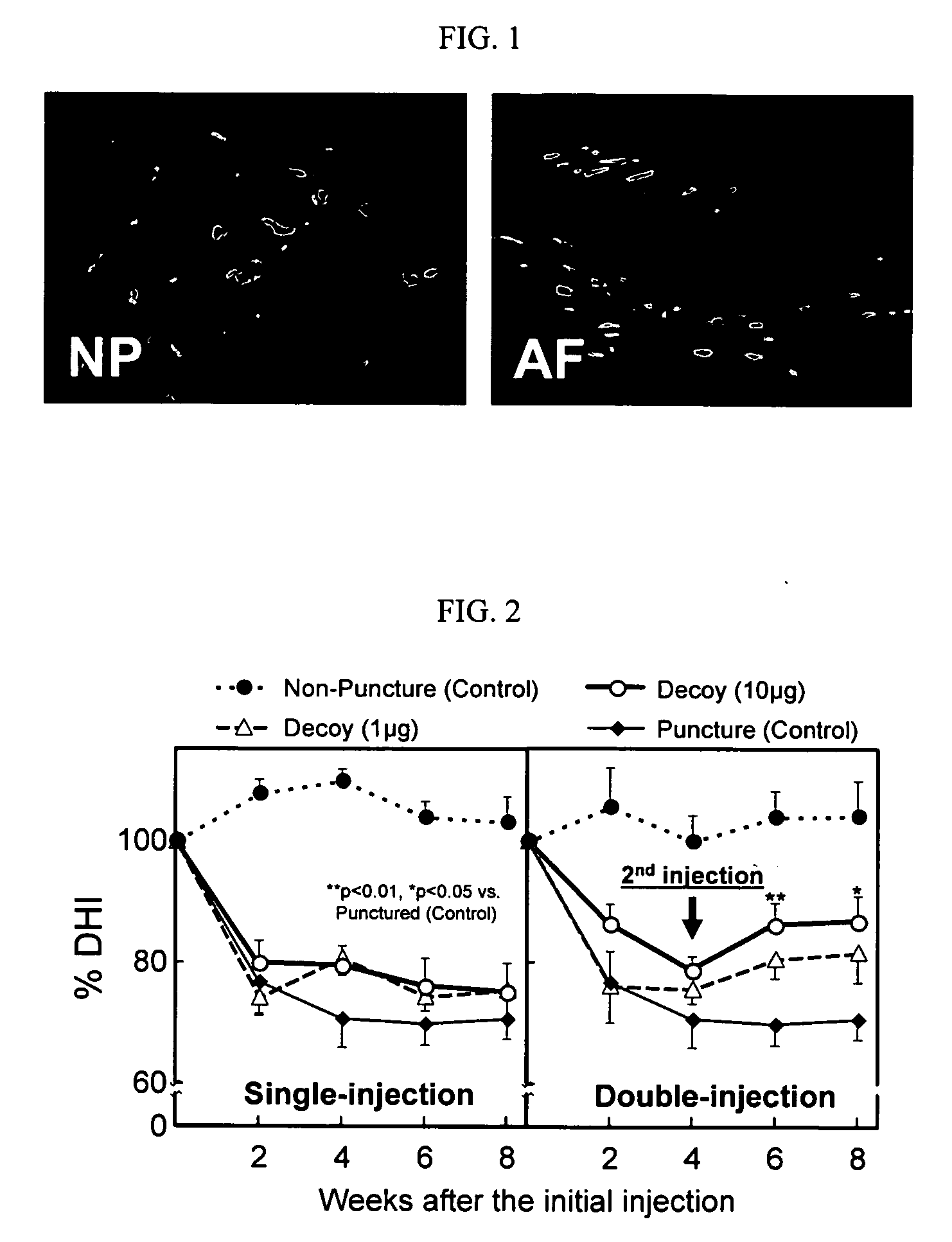 Methods and compositions for treating, inhibiting and reversing disorders of the intervertebral disc