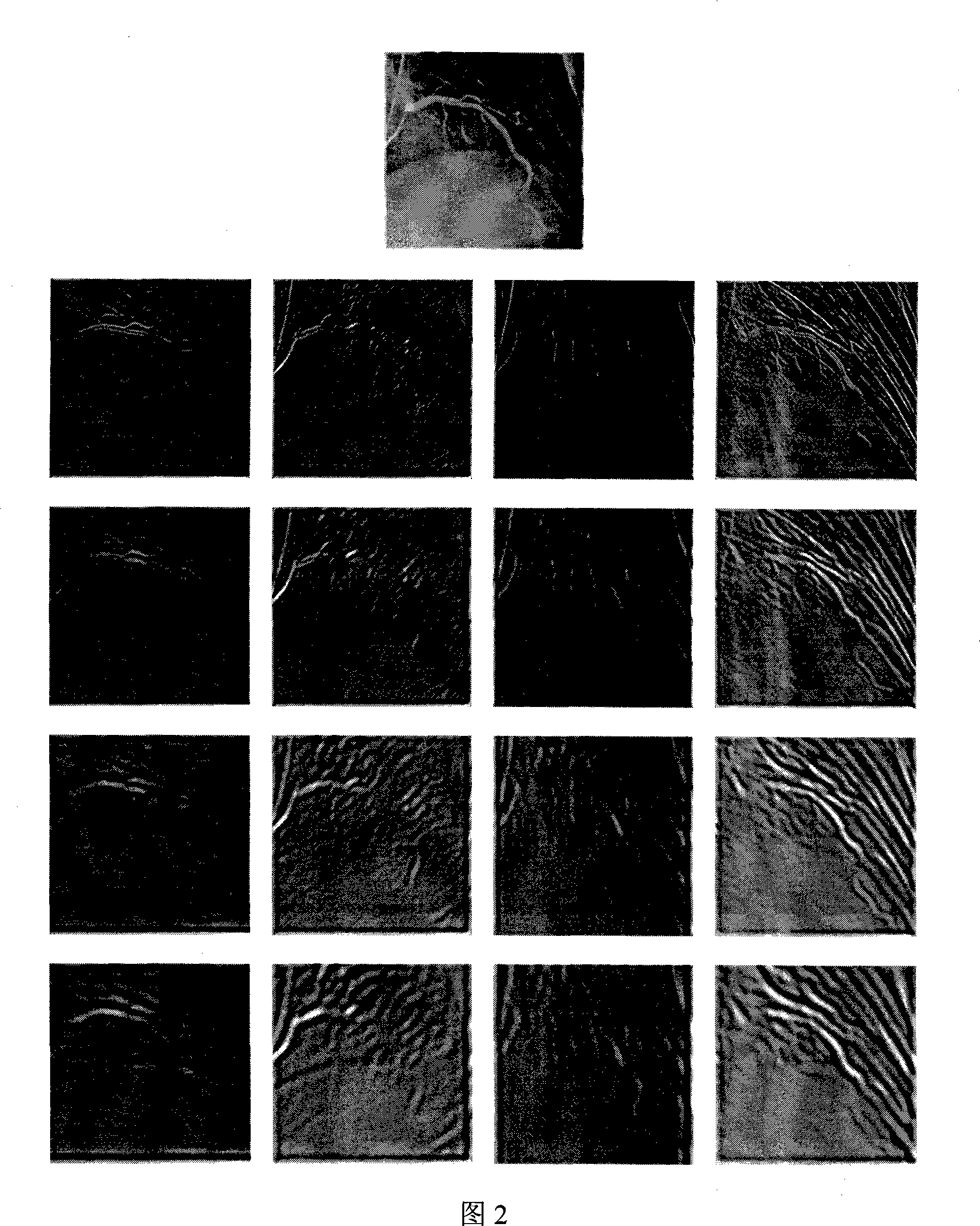 Digital blood vessel contrast image enhancement method integrating context information