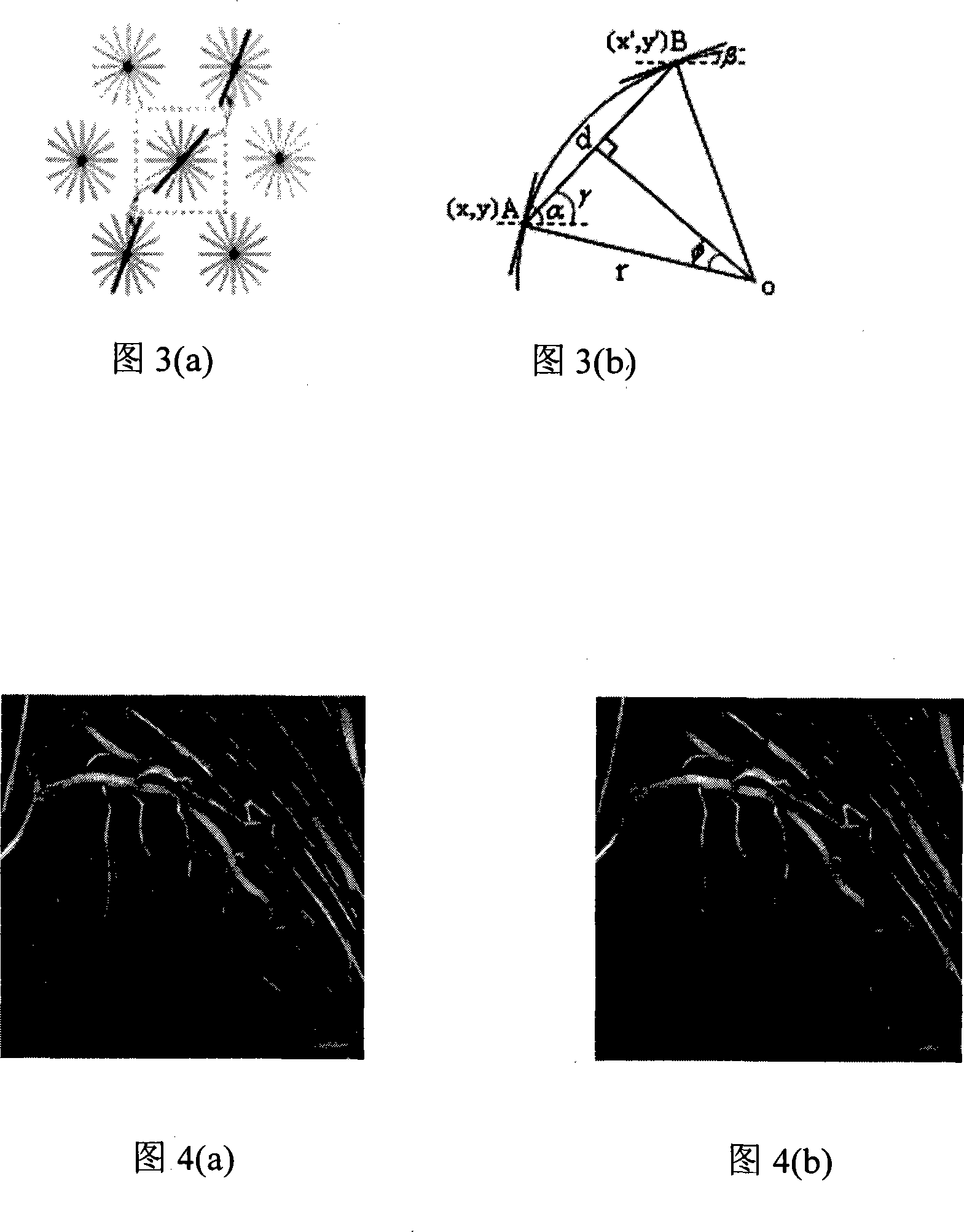 Digital blood vessel contrast image enhancement method integrating context information