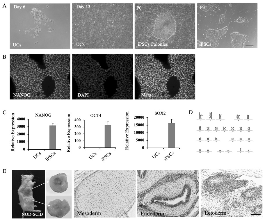 Method for differentiating and preserving non-integrated feeder-layer-free human urine-derived induced pluripotent stem cells into neural stem cells