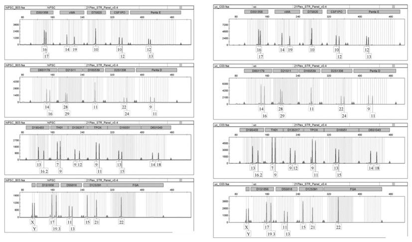 Method for differentiating and preserving non-integrated feeder-layer-free human urine-derived induced pluripotent stem cells into neural stem cells