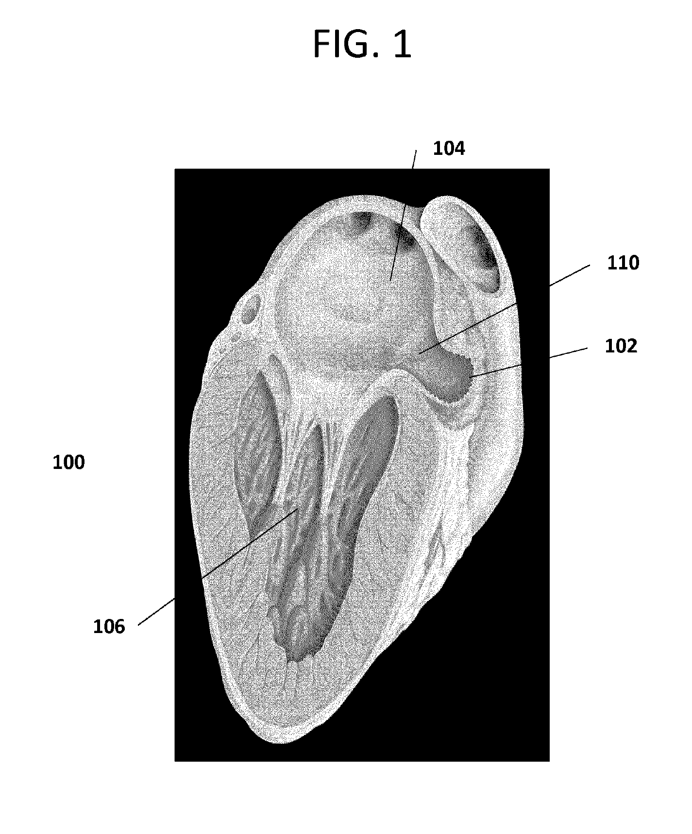 Devices and methods for excluding the left atrial appendage