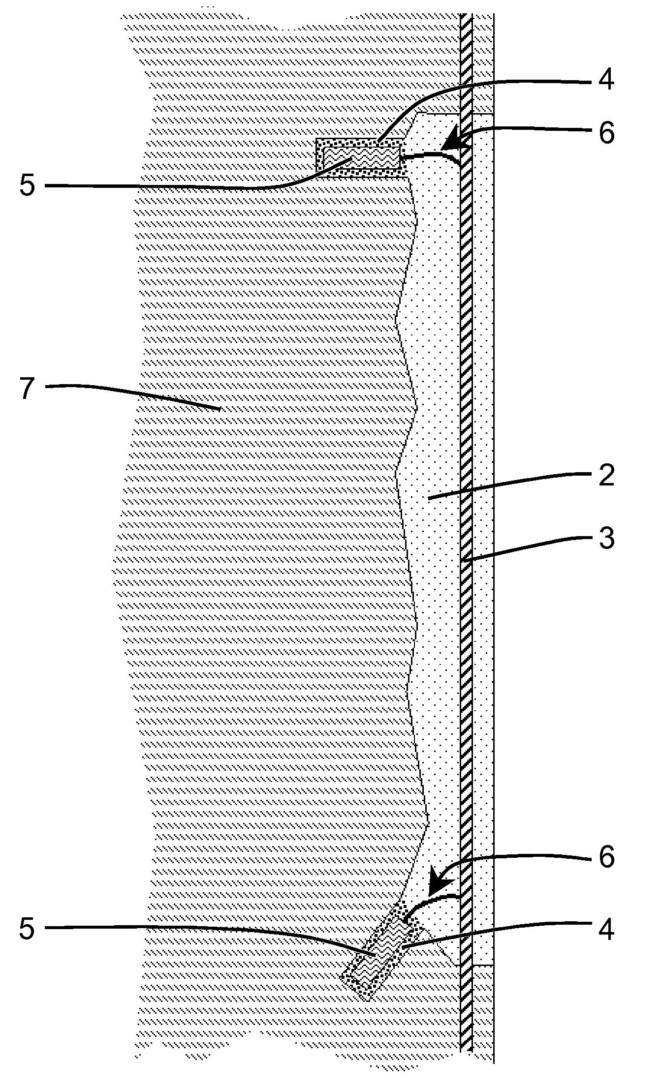 Sacrificial anodes in concrete patch repair