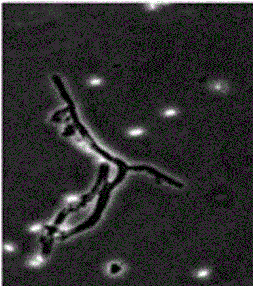 Hook-like trichoderma strain and application thereof