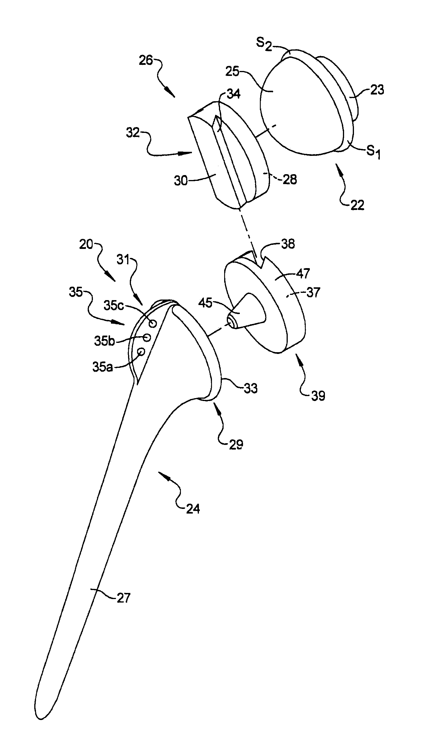 Humeral Implant Having A Floating Bearing