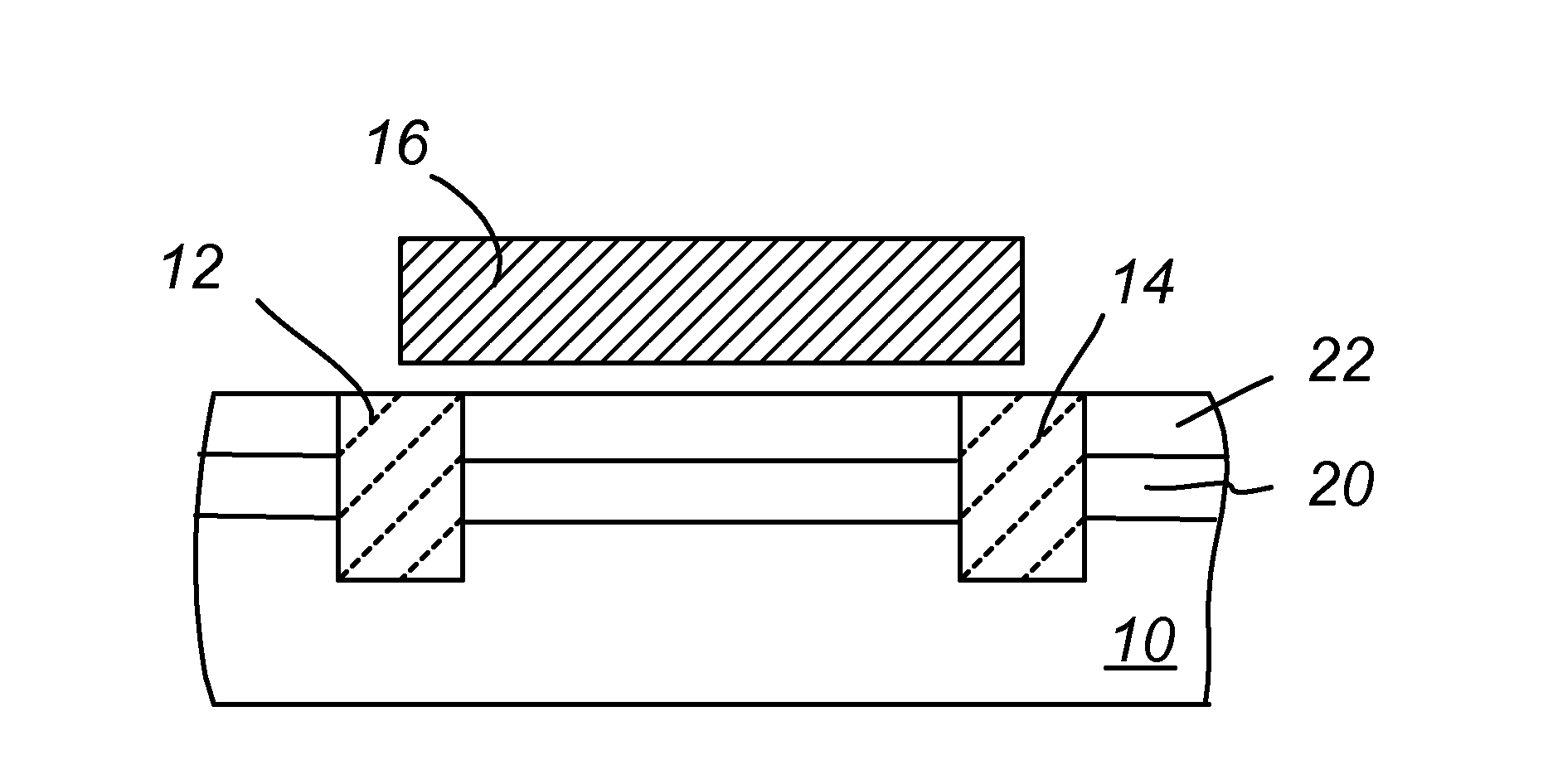 Transistor with longitudinal strain in channel induced by buried stressor relaxed by implantation