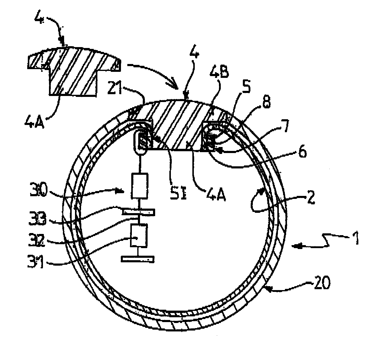 Pouch-Equipped Intragastric Balloon