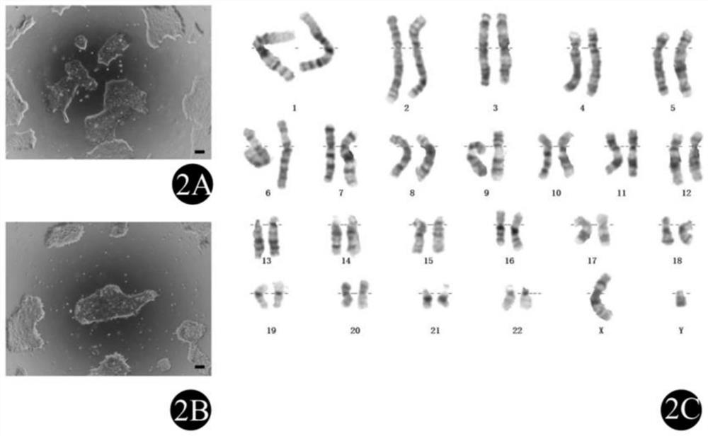 VSX2 green fluorescence reporter gene human induced pluripotent stem cell line and construction method thereof