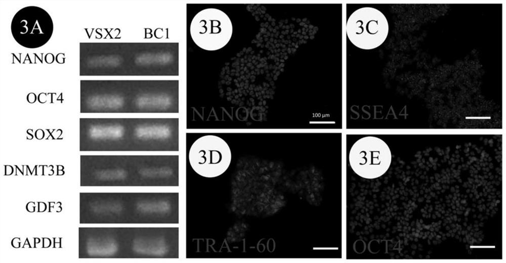 VSX2 green fluorescence reporter gene human induced pluripotent stem cell line and construction method thereof