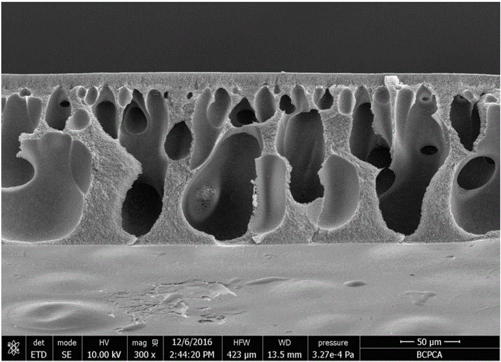 Cellulose acetate-based nano-material composite ultrafiltration membrane and preparation method thereof