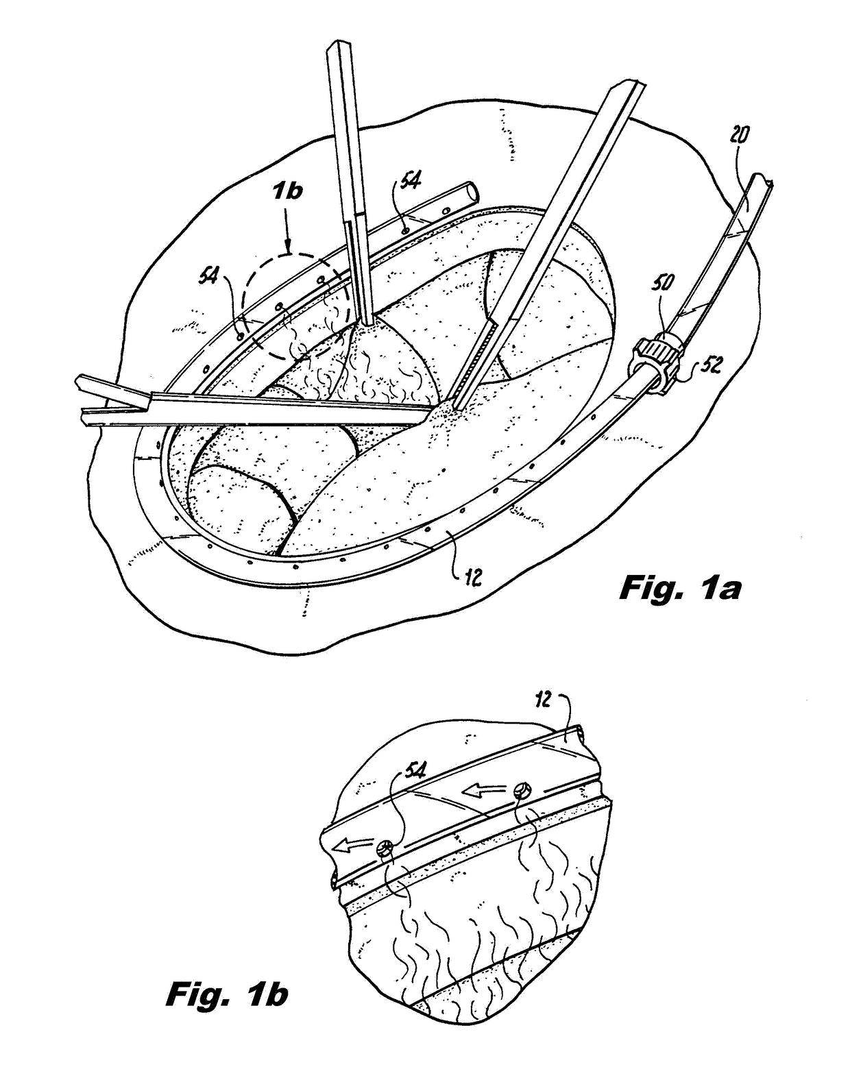 Smoke evacuation system for invasive surgical procedures