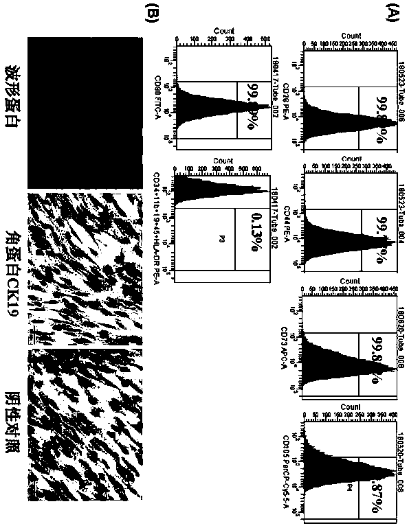 Method for inducing differentiation of human mesenchymal stem cells to osteoblasts and application thereof