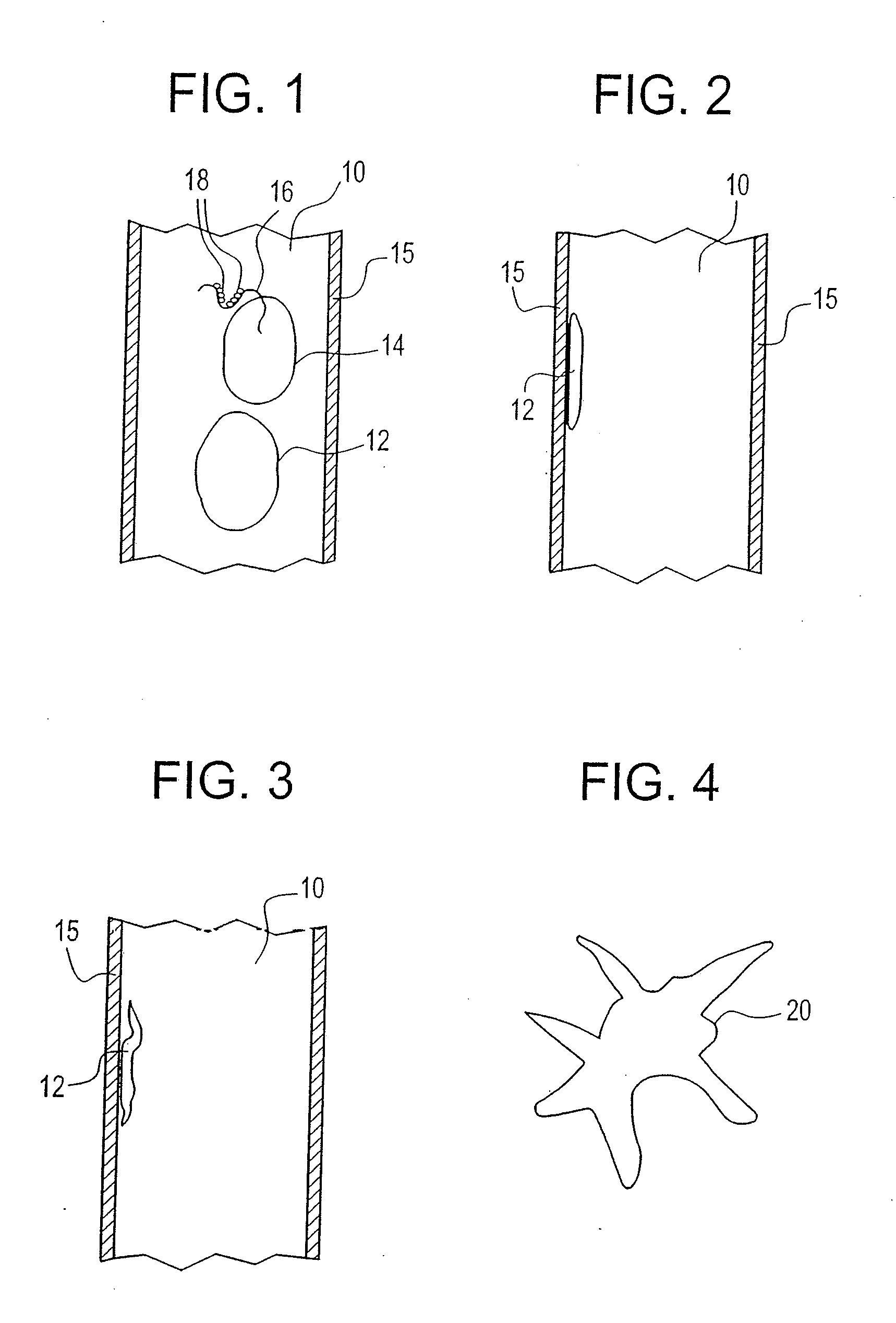 Methods for inducing the differentiation of blood monocytes into functional dendritic cells