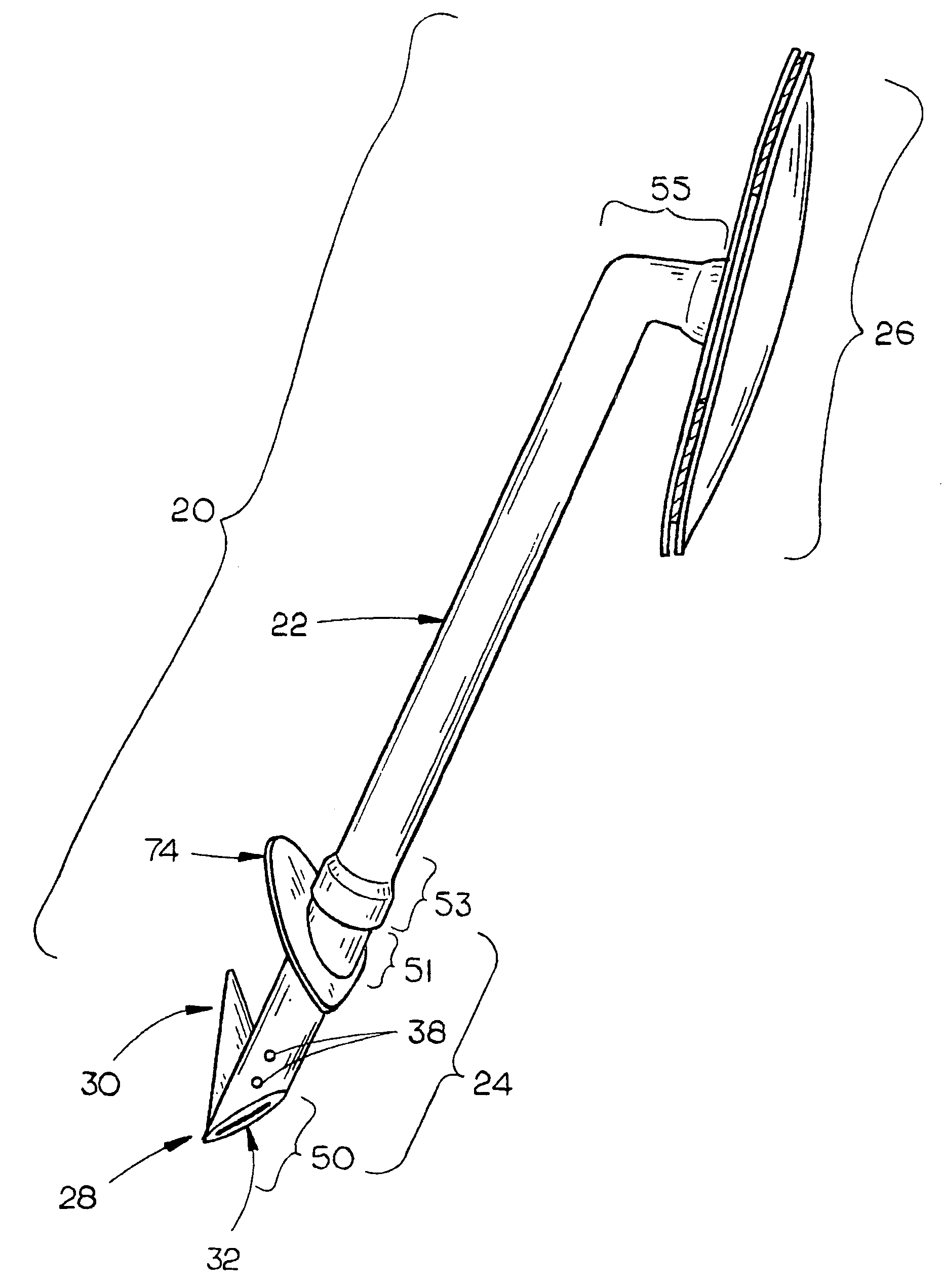 Method and apparatus for reducing intraocular pressure