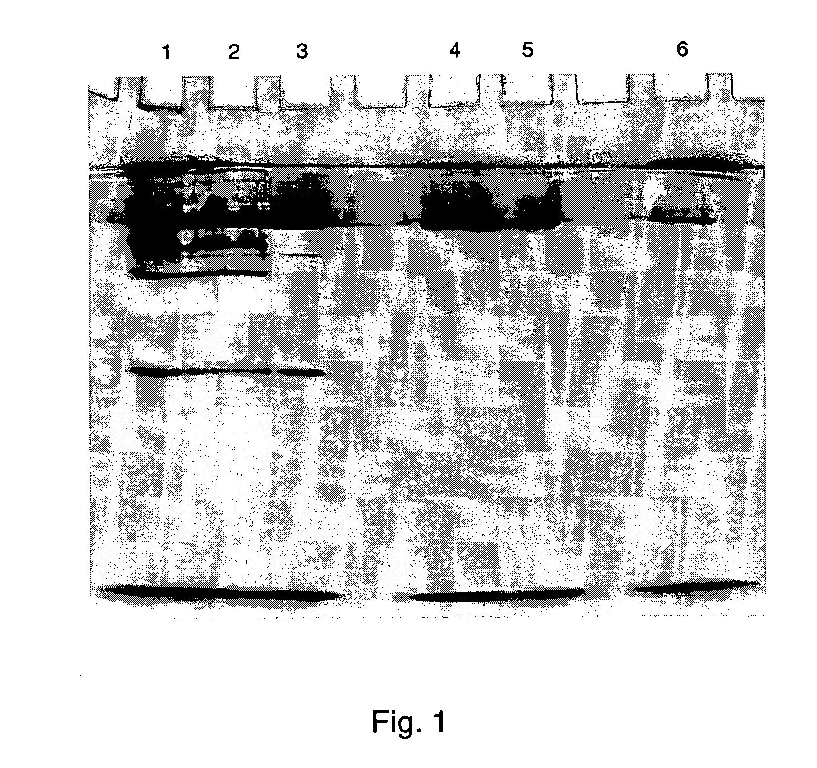 Alcohol dehydrogenases with increased solvent and temperature stability