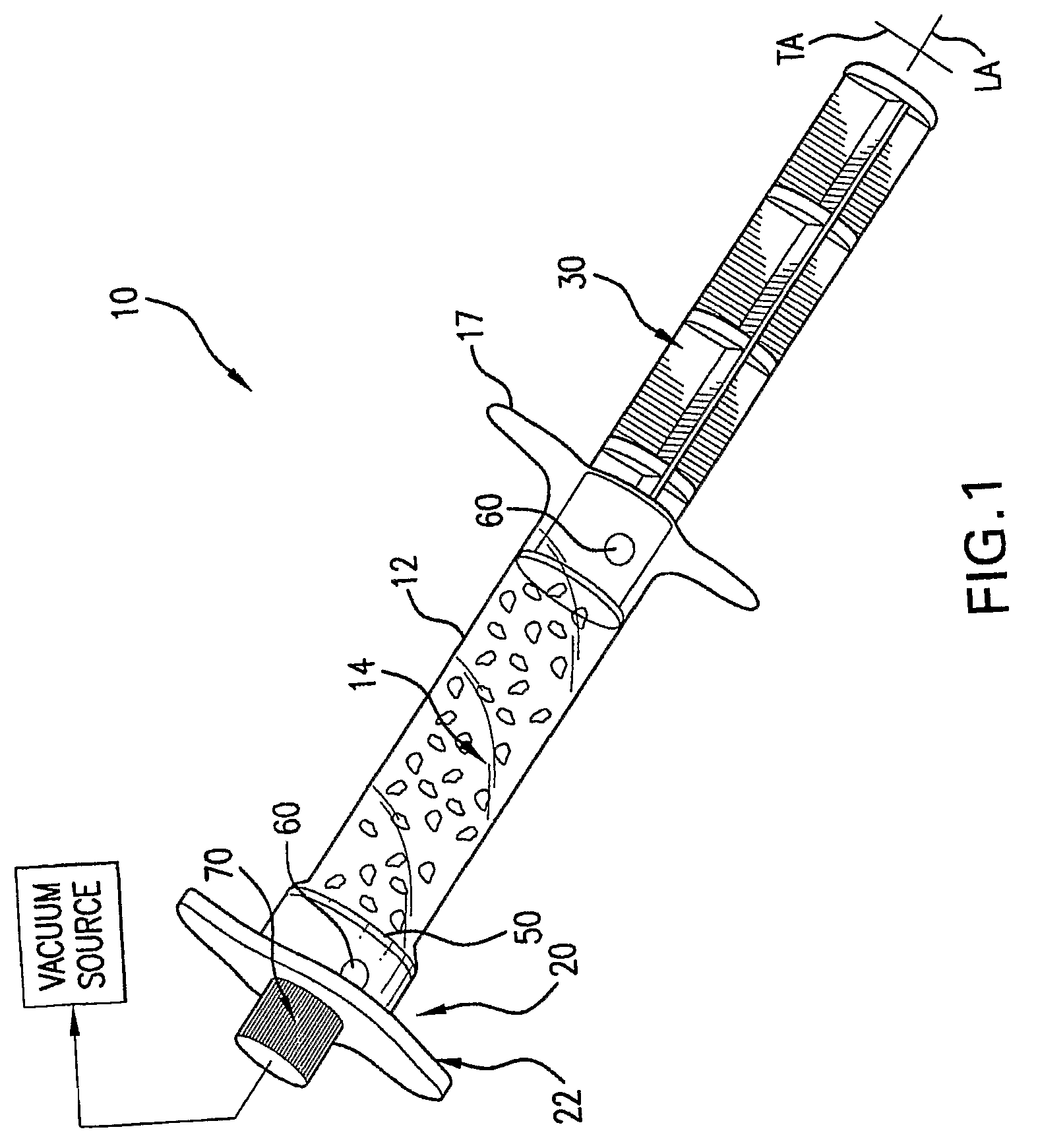 Perfusion device and method