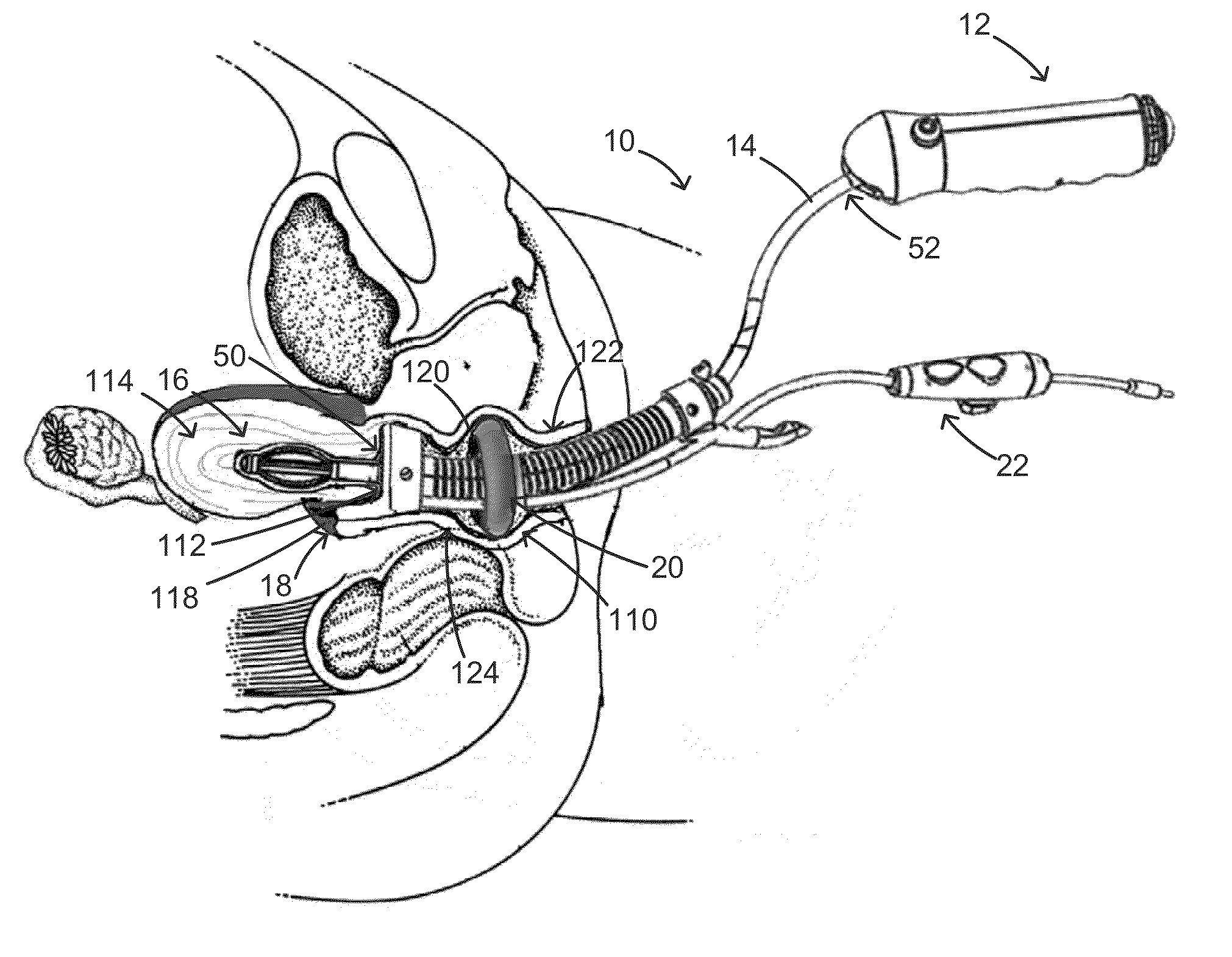 Functional uterine manipulator