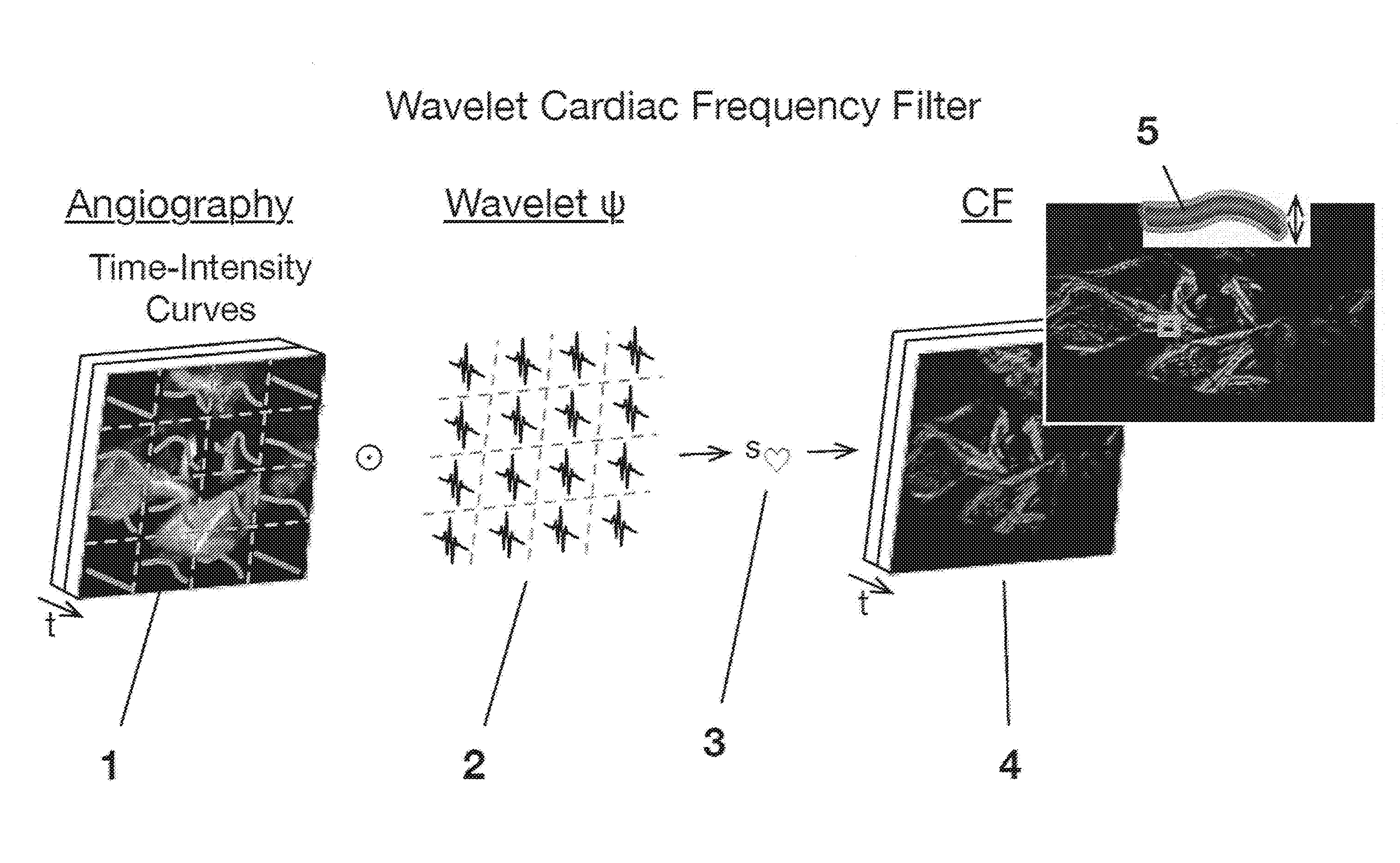 Device and method for spatiotemporal reconstruction of a moving vascular pulse wave in the brain and other organs