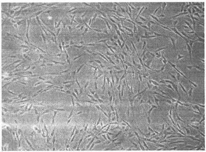 Preparation method and application of a novel regulatory dendritic cell