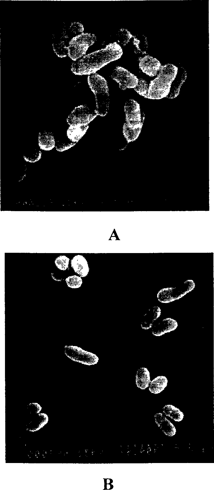 Glutamic acid capable of having high-yield glutamine