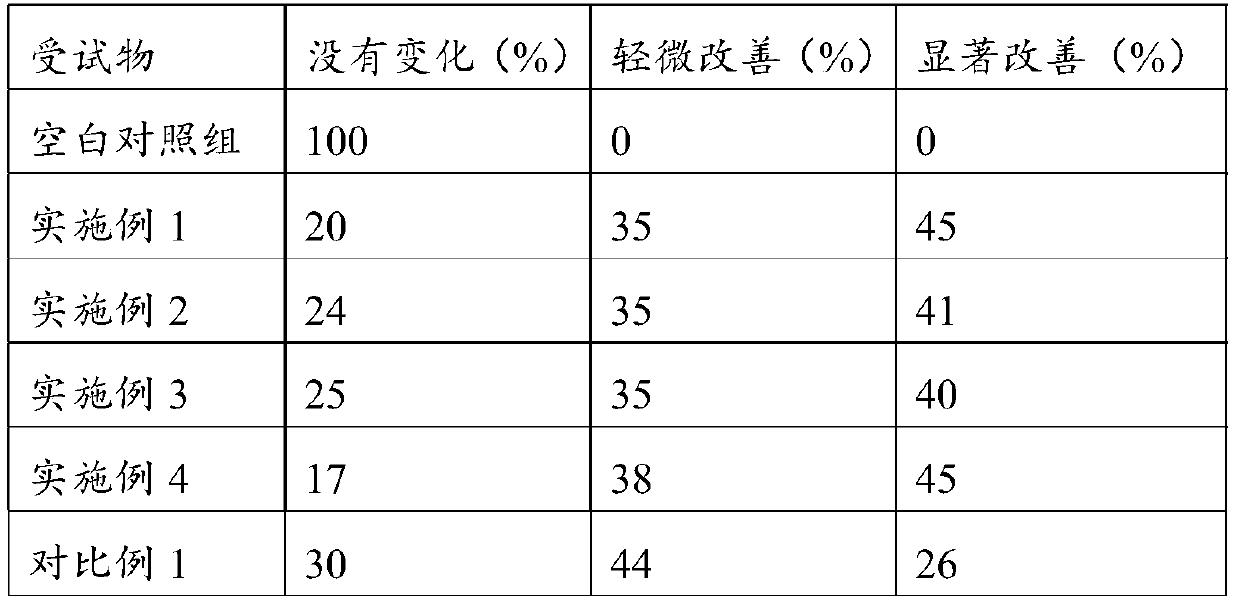 Composition and product for preventing and treating alopecia and preparation method of product