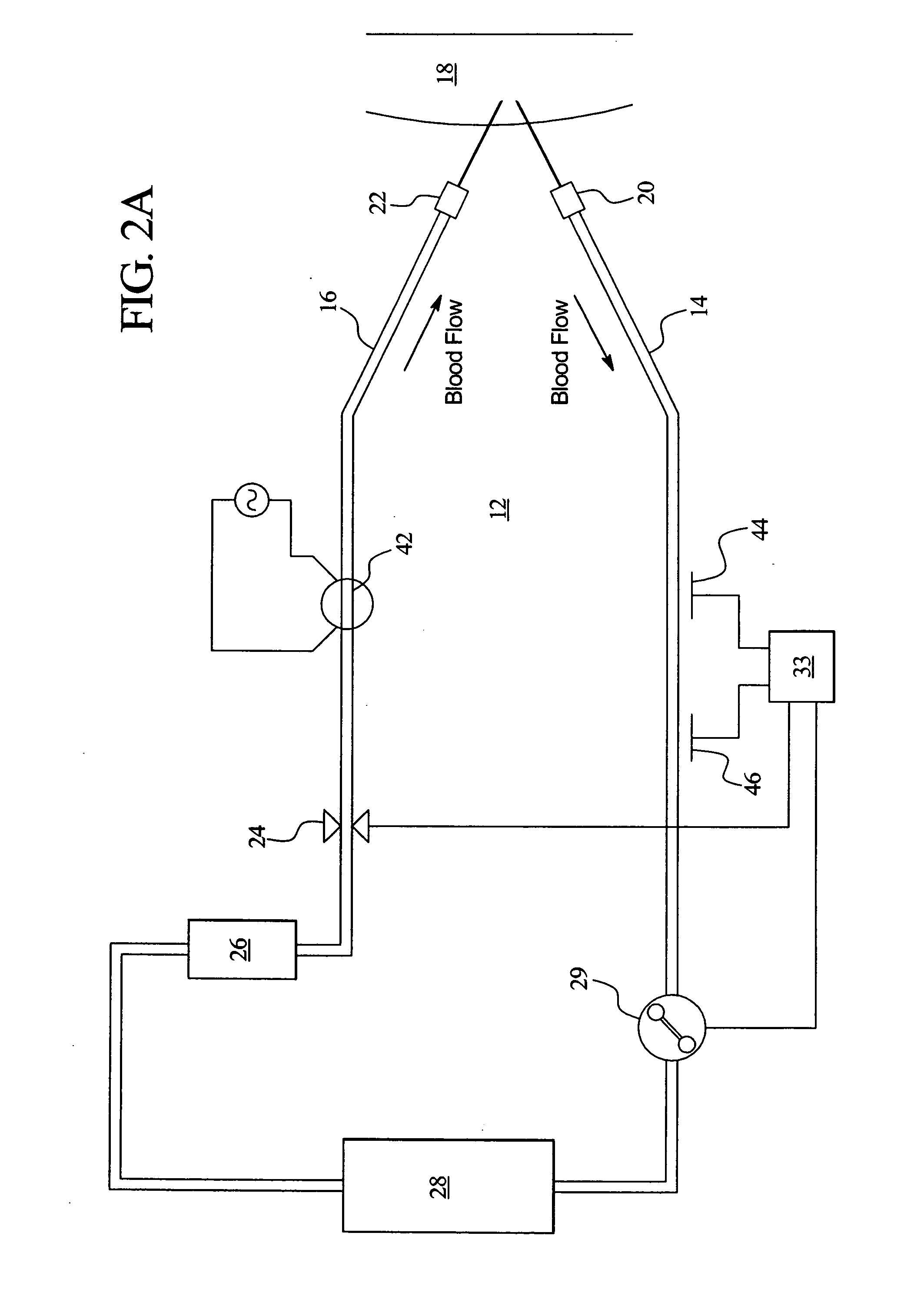 Access disconnection systems and methods