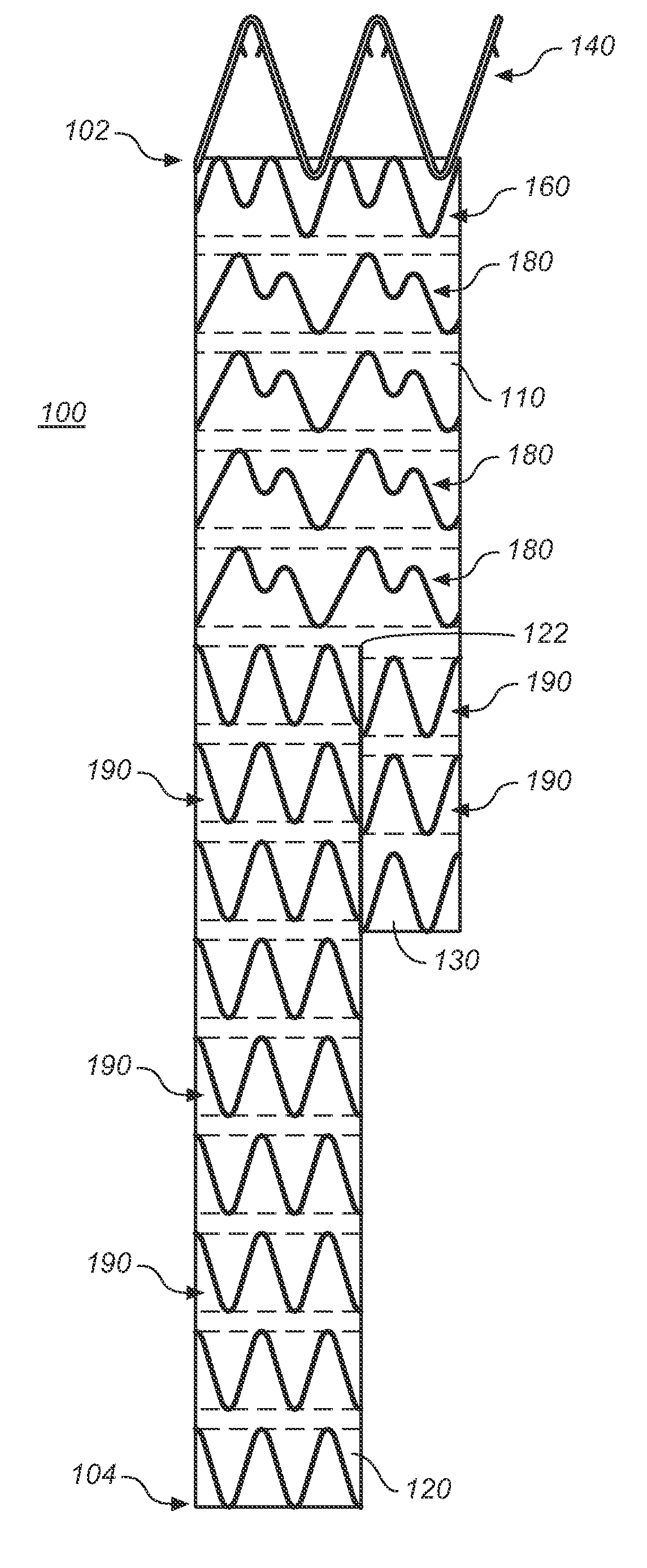 Endoluminal Prosthesis