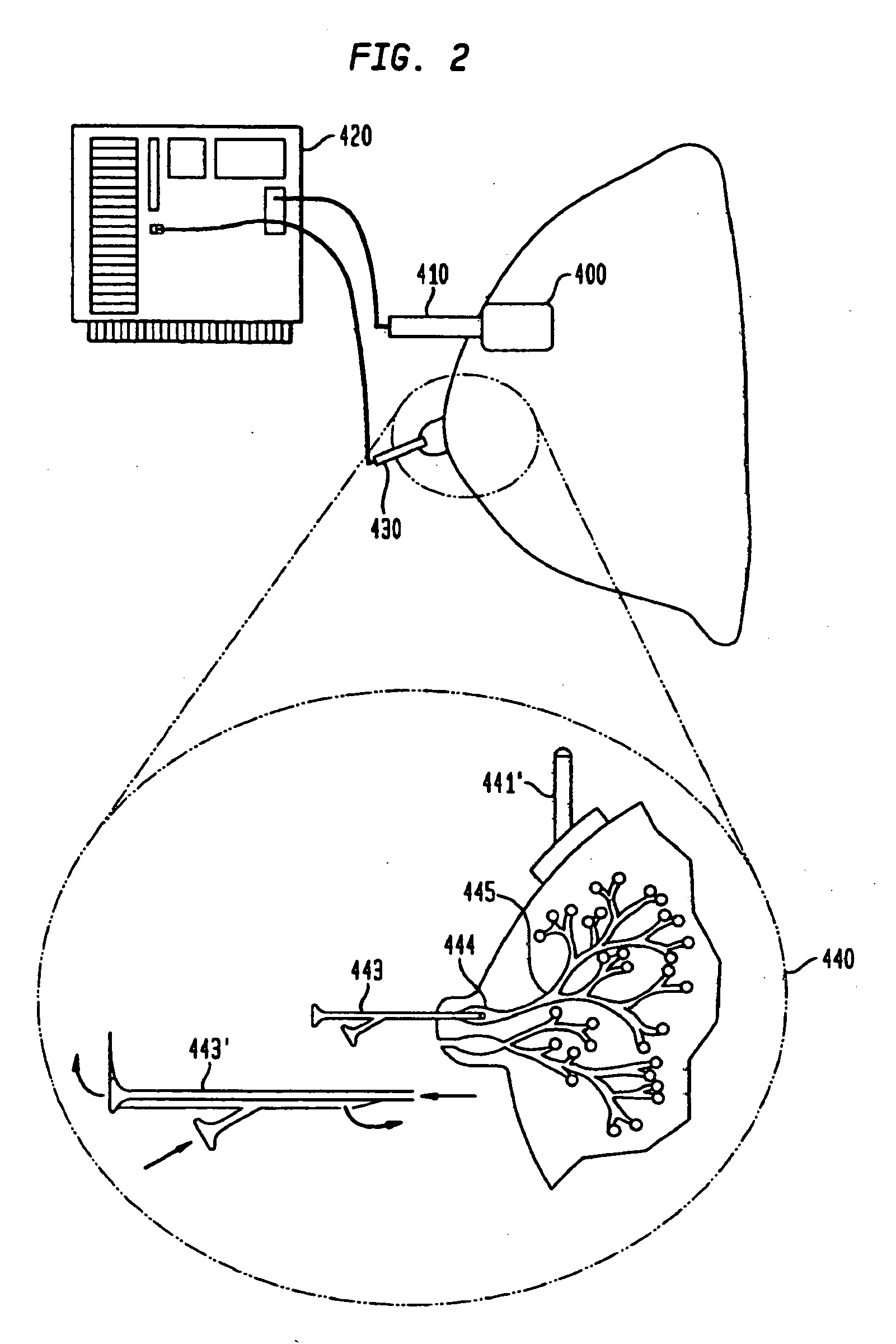 Electrical bioimpedance analysis as a biomarker of breast density and/or breast cancer risk