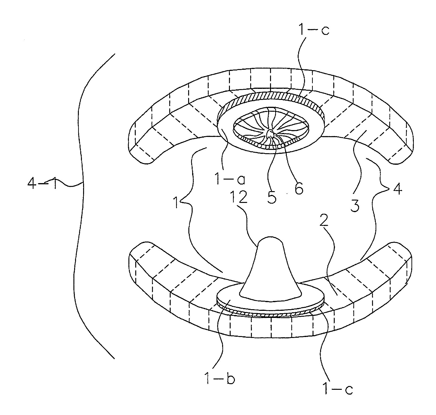 Pre-fabricated anterior guidance package kit for patients having bruxism/clenching habit with or without various malocclusions