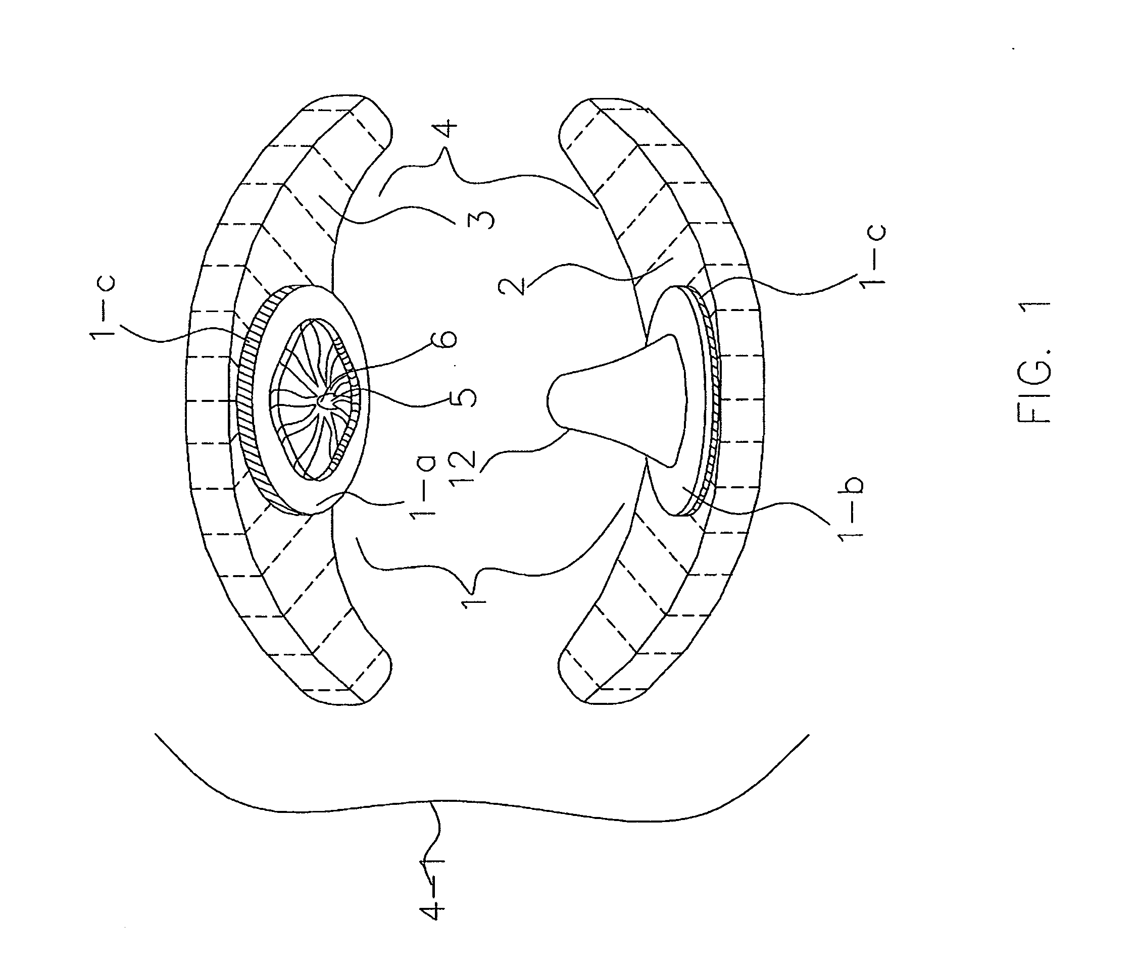 Pre-fabricated anterior guidance package kit for patients having bruxism/clenching habit with or without various malocclusions