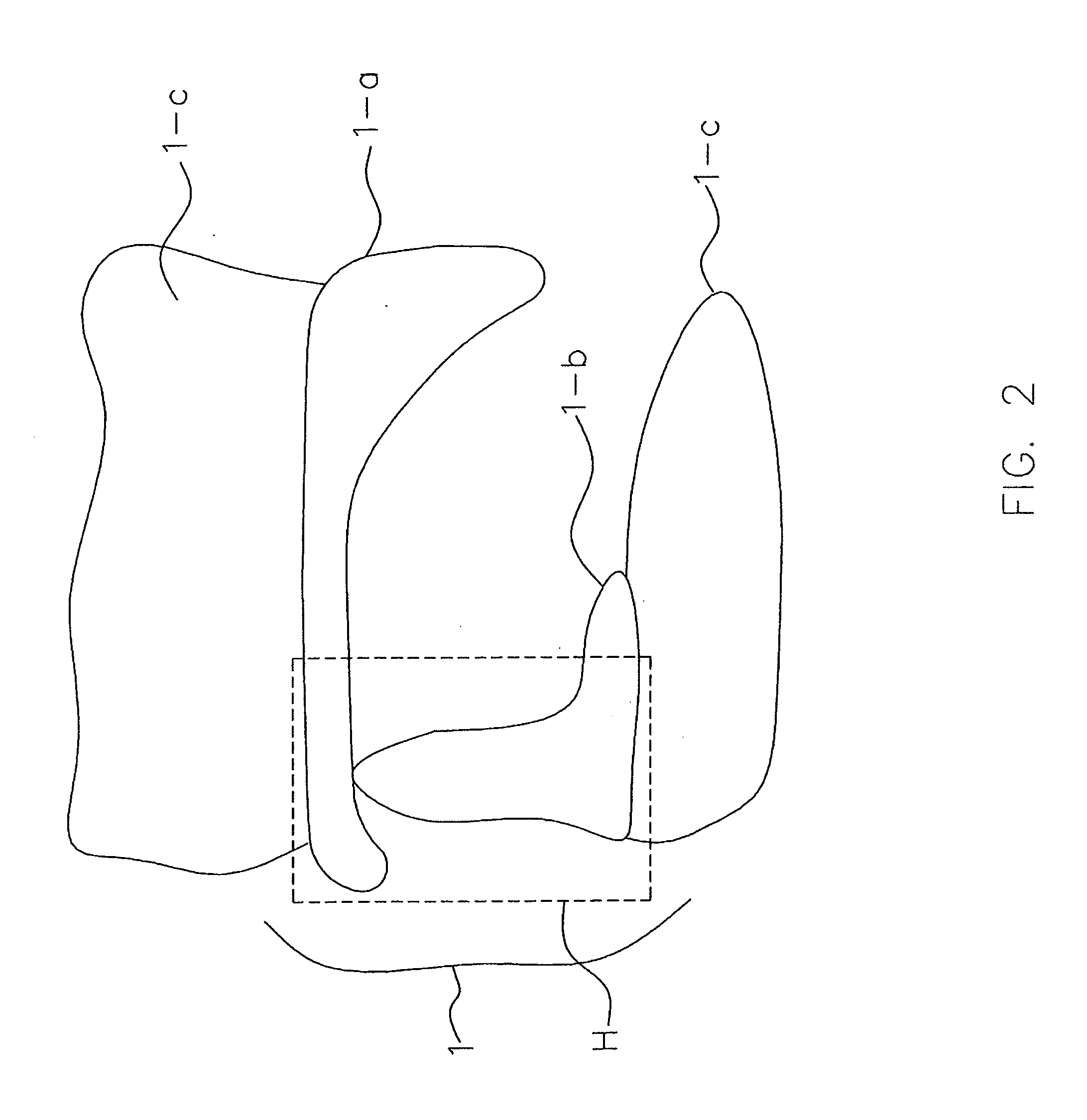 Pre-fabricated anterior guidance package kit for patients having bruxism/clenching habit with or without various malocclusions