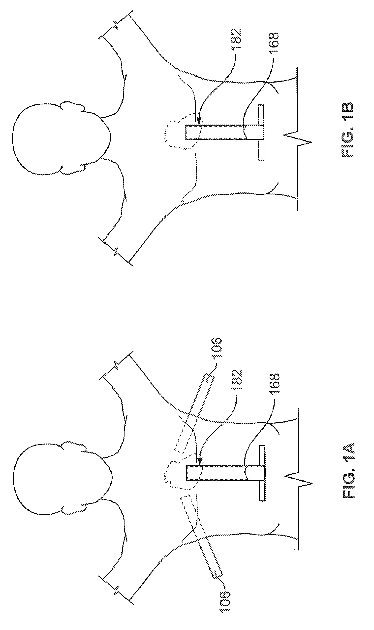 Diaphragm entry for posterior surgical access