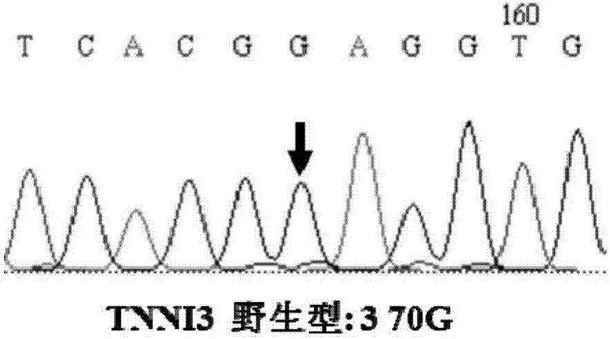 Primer combination and applications thereof