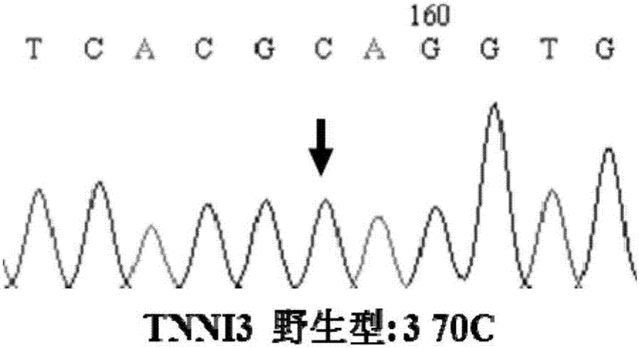 Primer combination and applications thereof