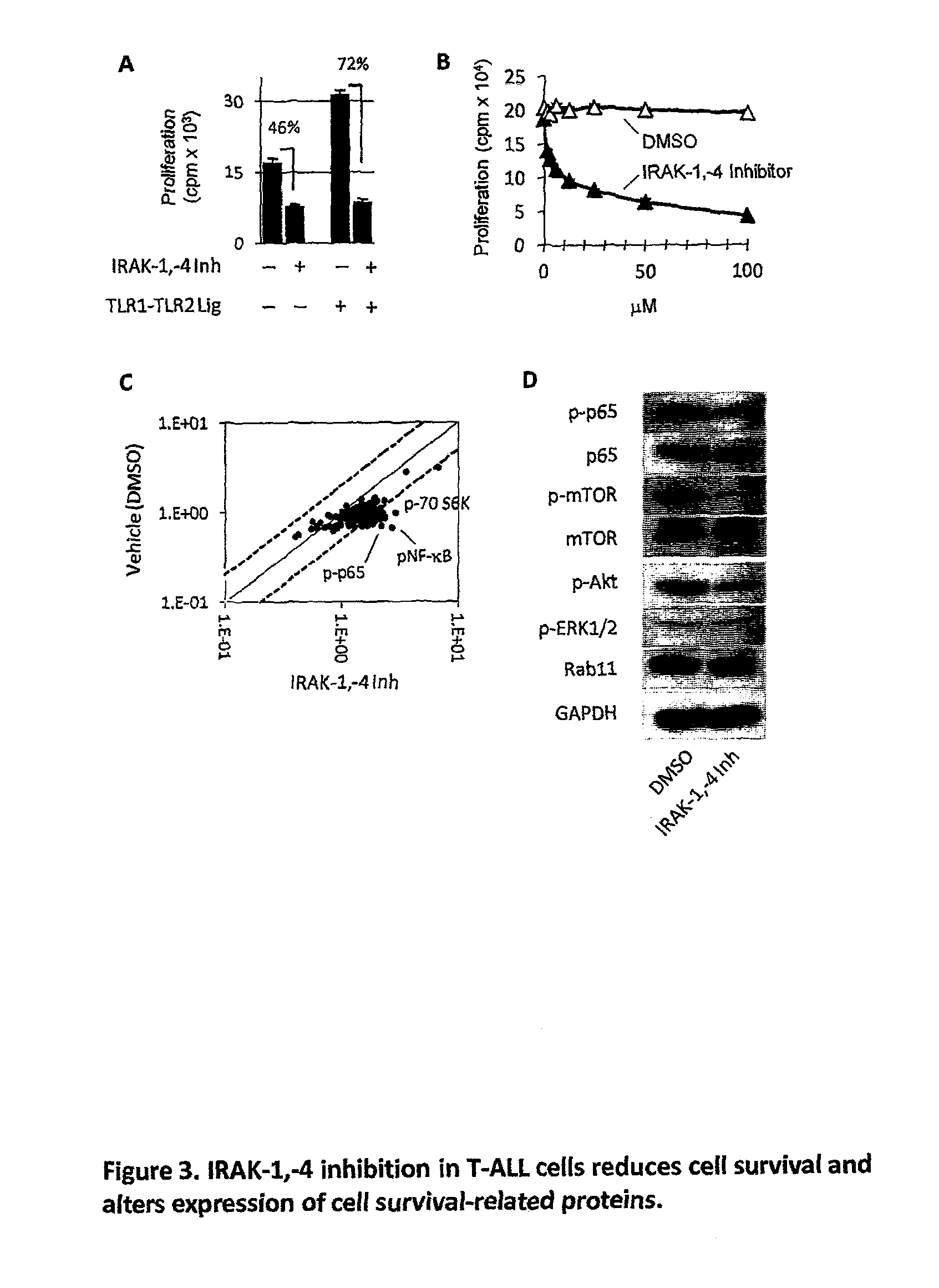 Total and phosphorylated IL-1 receptor-associated kinase-1 and IL-1 receptor-associated kinase-4 as a biomarker for cancer progression and chemotherapy resistance