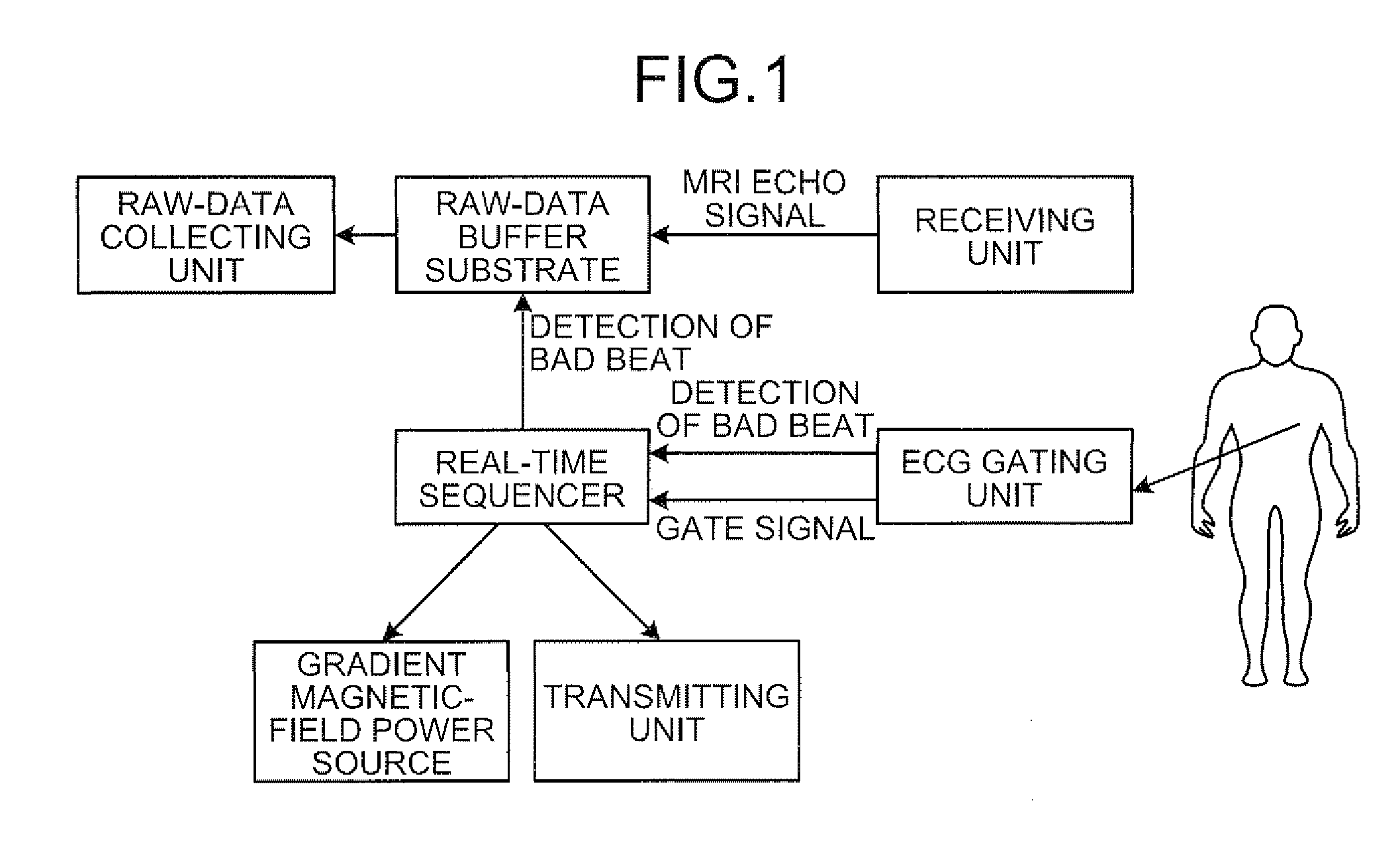 Magnetic resonance imaging apparatus and magnetic resonance imaging method