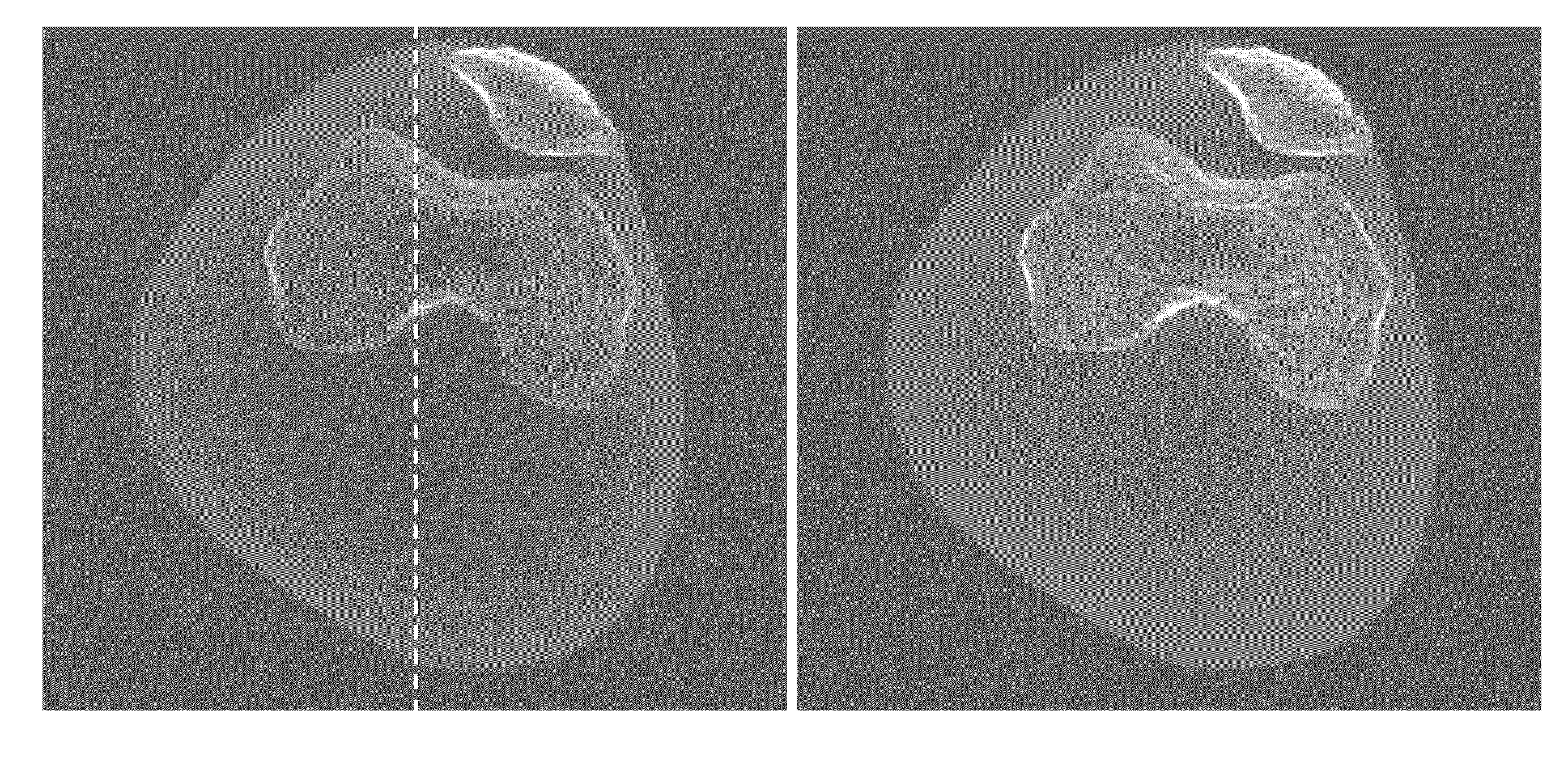 Methods and apparatus for scatter correction for cbct system and cone-beam image reconstruction