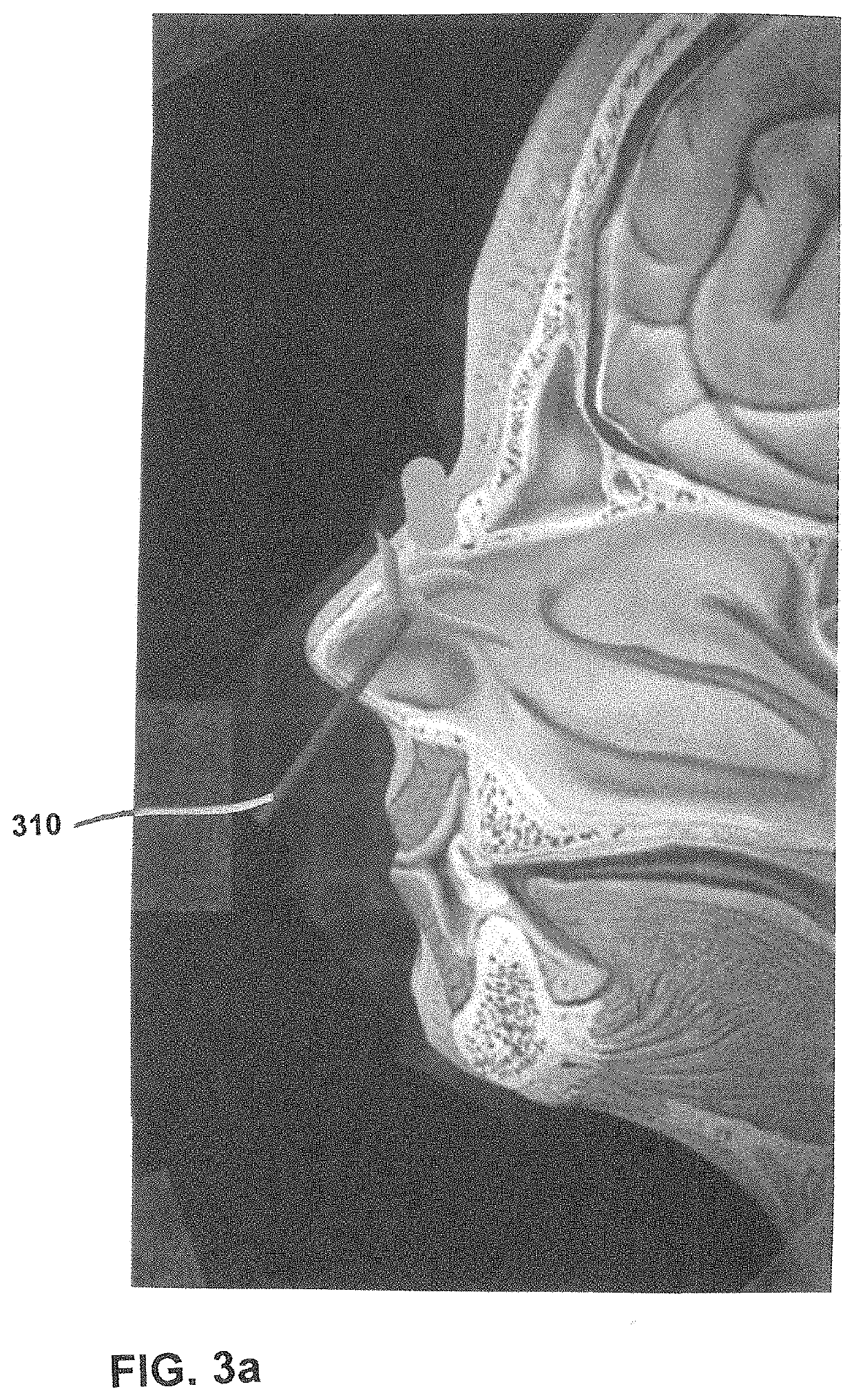 Method for Treating Head or Cranium Pain Including Migraine and Cluster Headaches