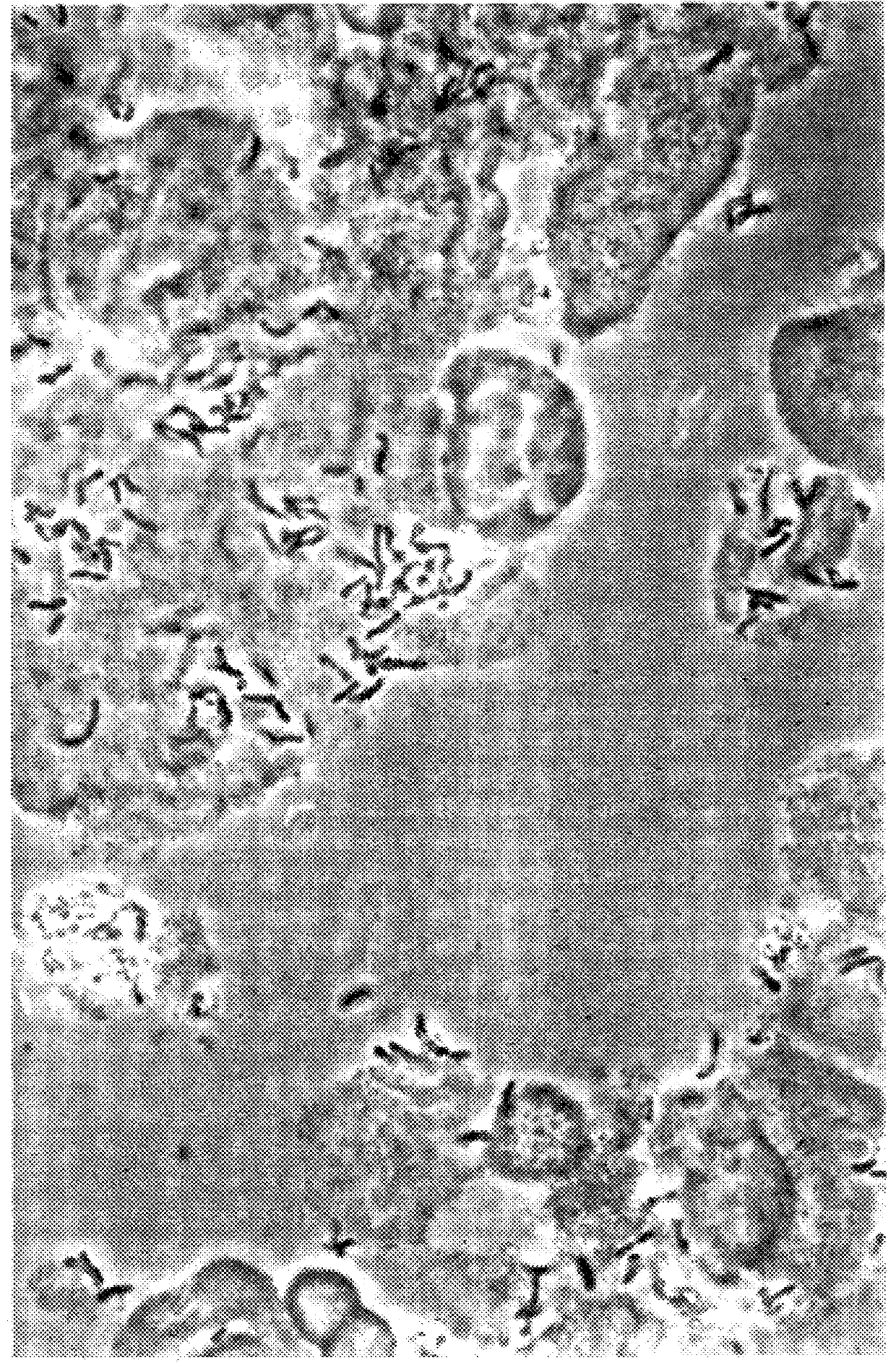 Probiotic compositions