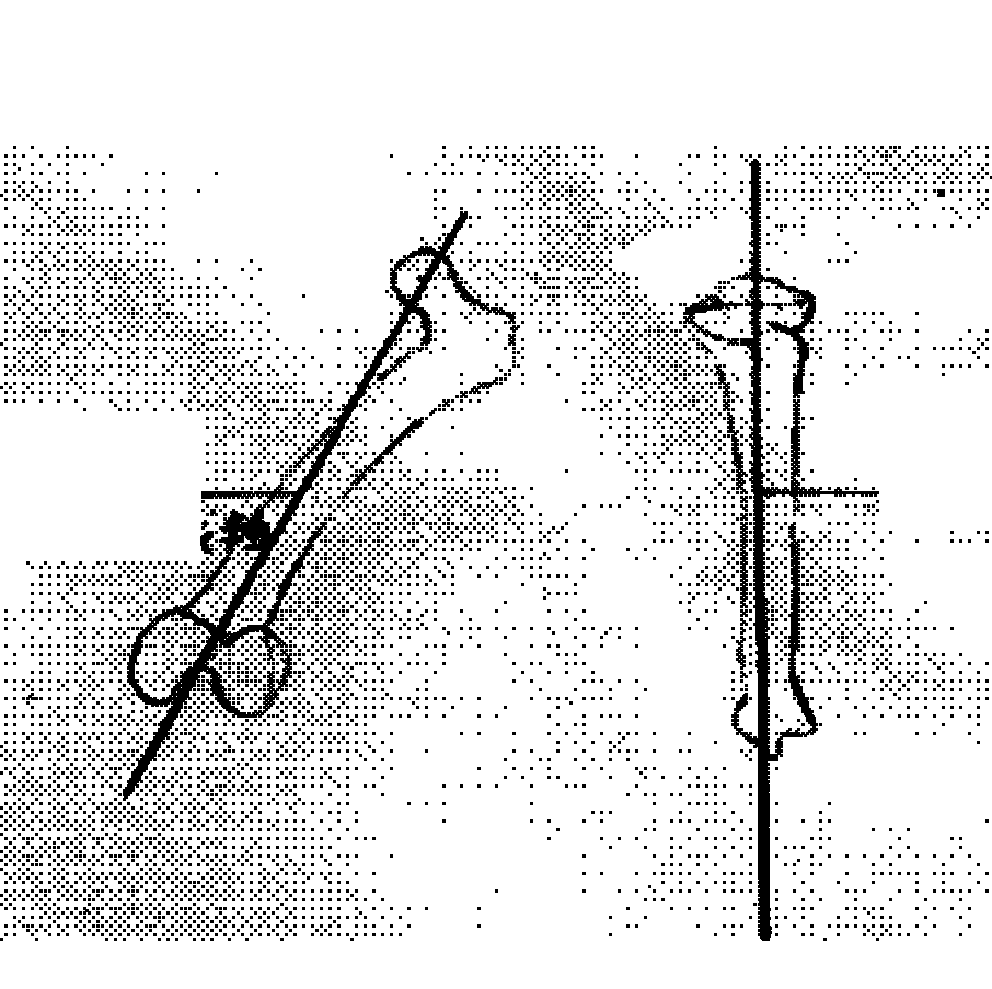 Method for manufacturing navigation template for knee replacement, and navigation template