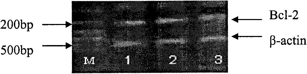 Application of small RNAs in preparing medicaments for treating and/or preventing lymphoma