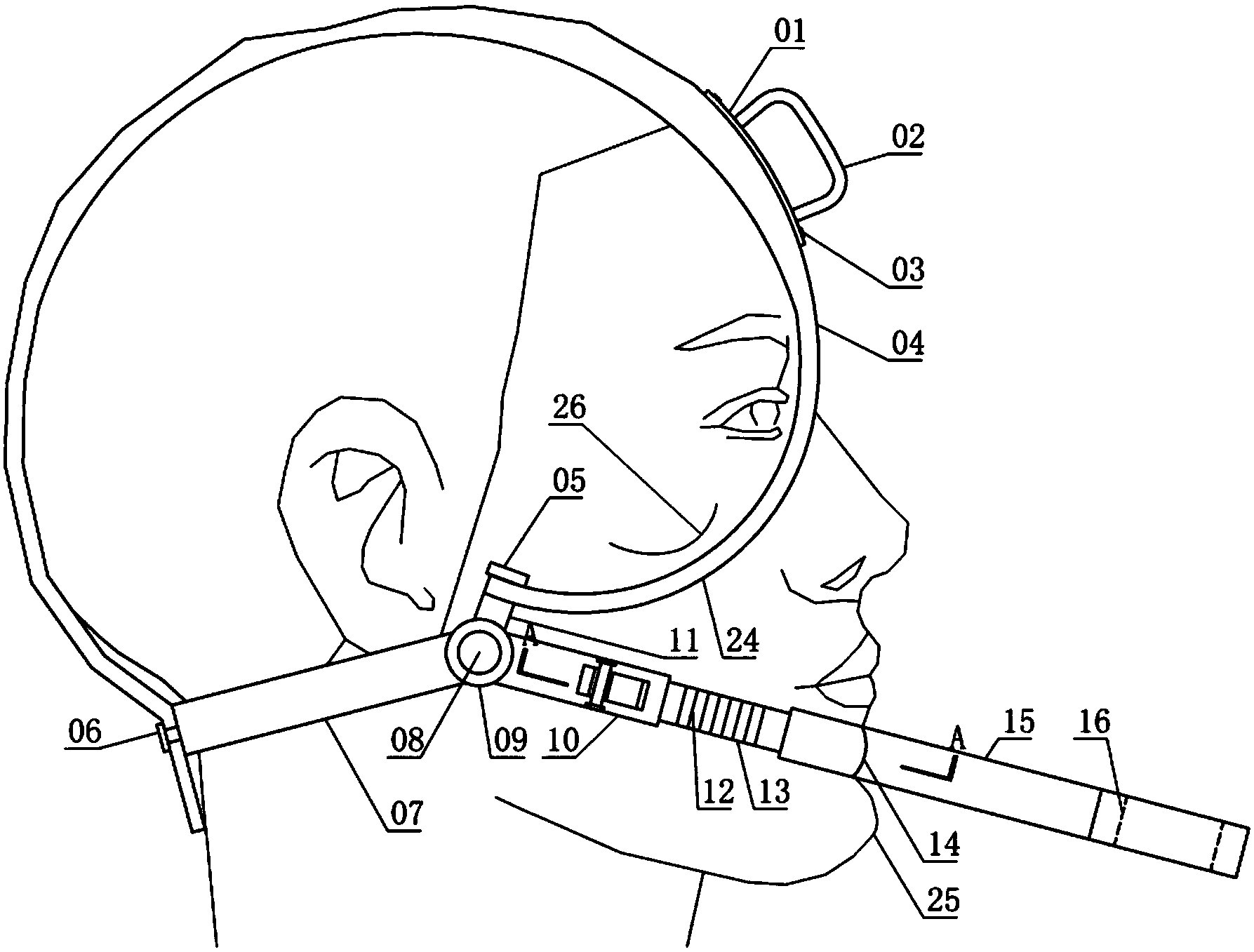 Zygomatic chin expansion angle type opening device