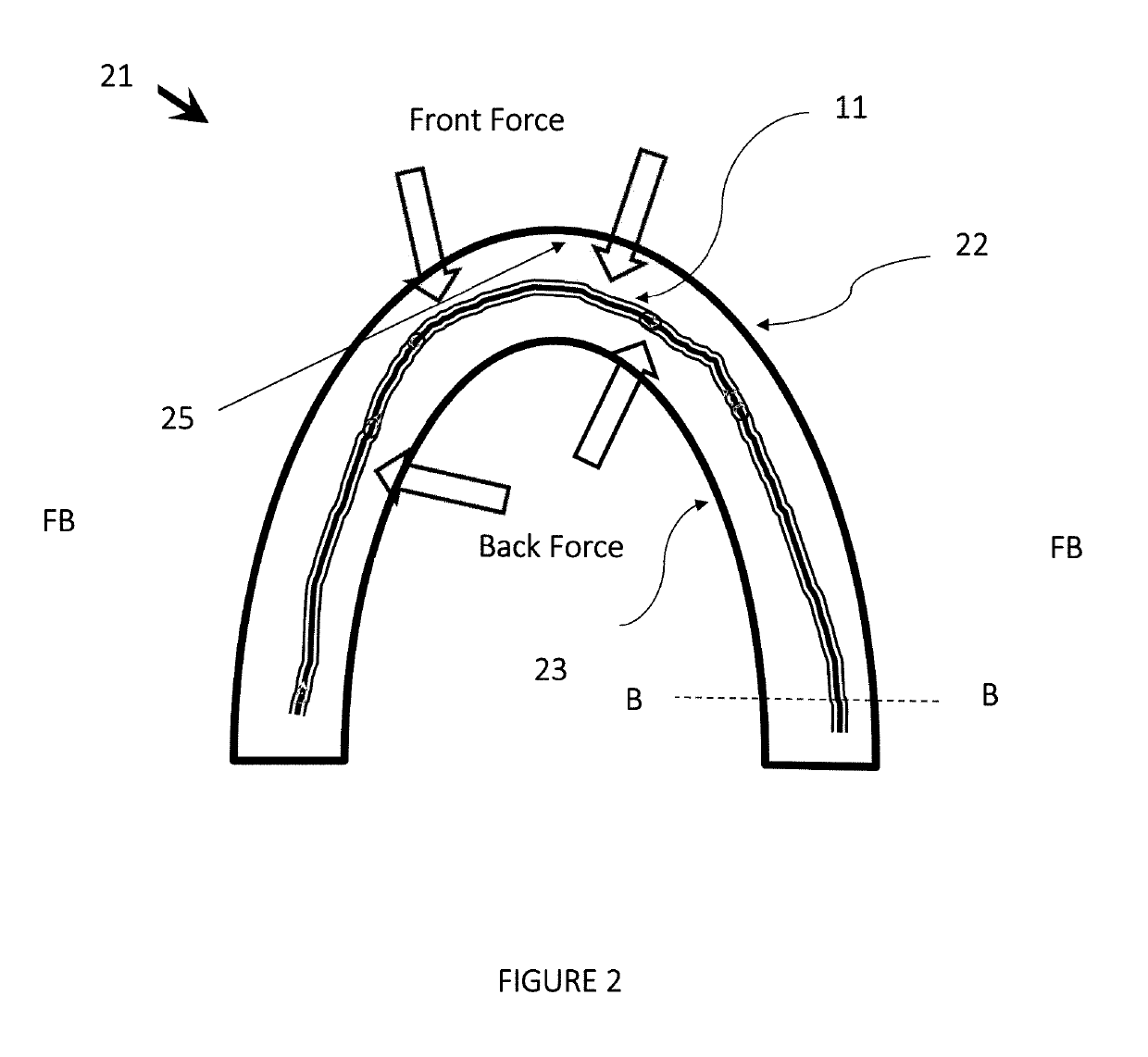 Teeth Aligner System